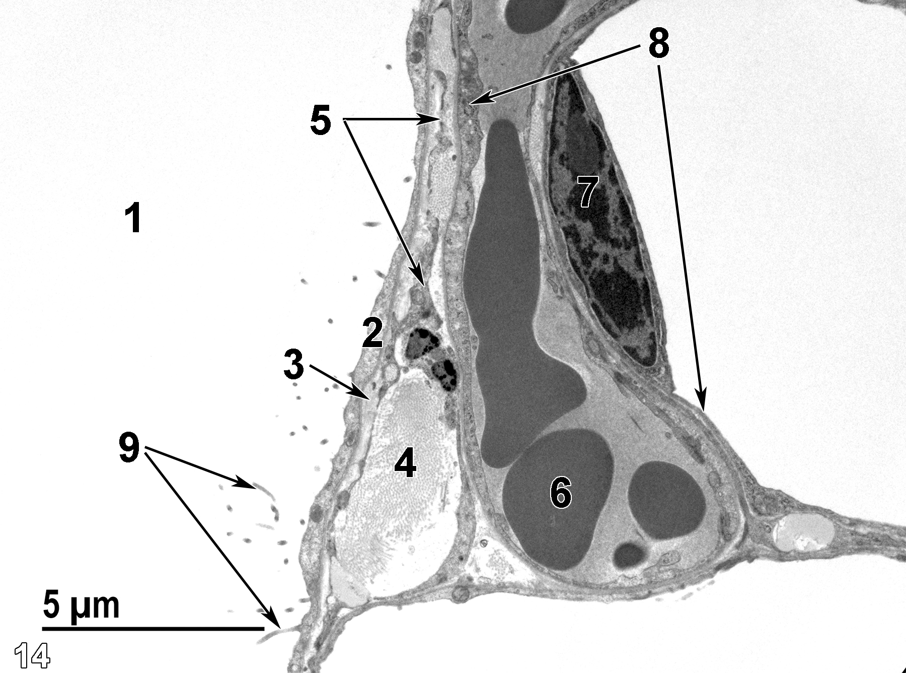 <strong>Figure 14.</strong> Another view of the pleural surface. The thin pleural mesothelial cell layer (2) has microvilli (9, arrows) extending into the pleural cavity(1). Directly below the mesothelial cells is an elastic membrane (3, arrow) that is underlain by collagen bundles (4). Cytoplasmic strands of fibroblasts (5, arrows) are within the layer of collagenous tissue. Endothelium (8, arrows) lines a capillary containing erythrocytes (6) that is adjacent to a larger vessel also lined by a thin endothelium (8) with an elongate nucleus (7). 6800x.