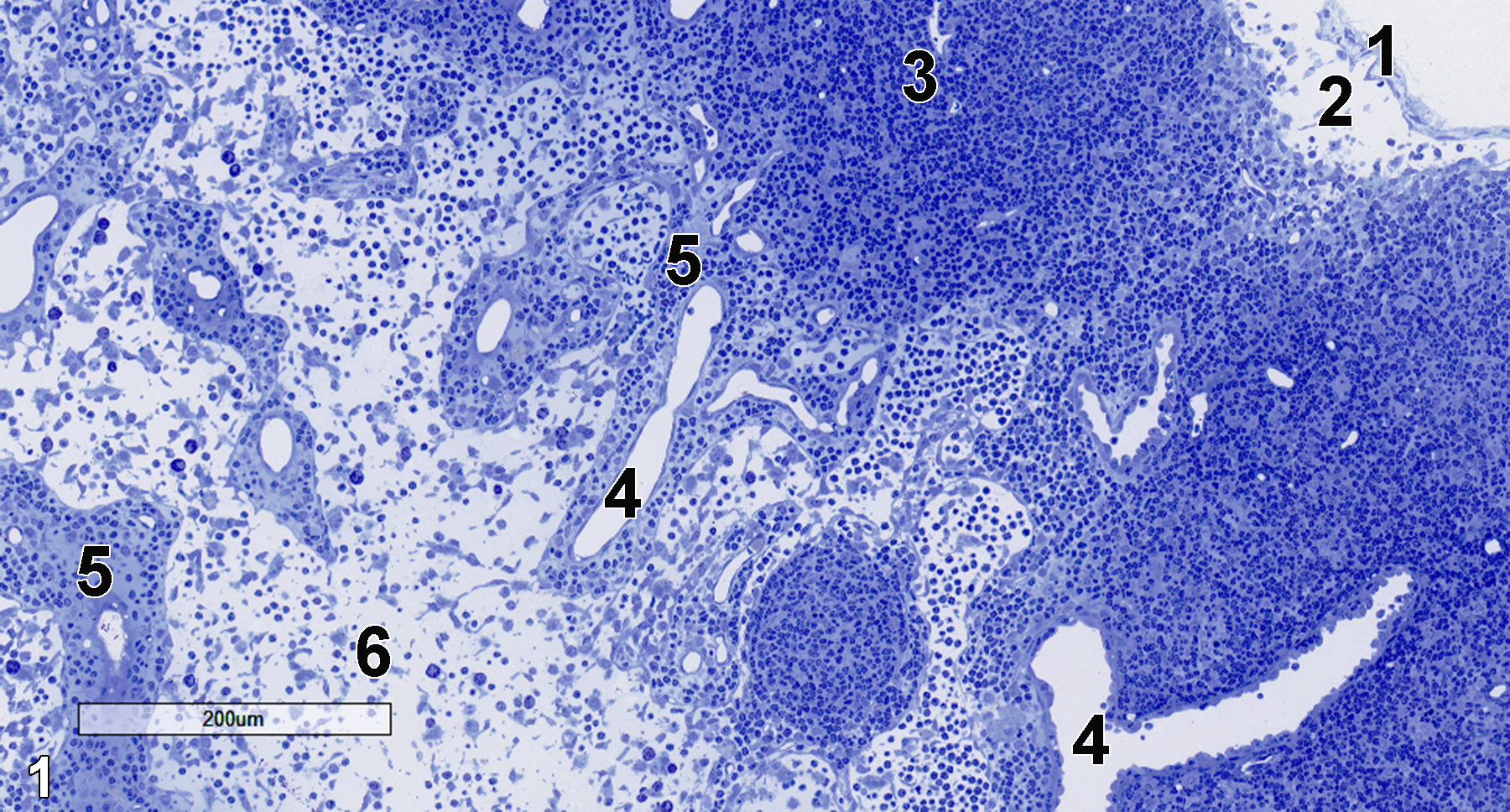 <strong>Figure 1.</strong> A semithin section (0.5 micrometer thick) of a toluidine blue O-stained portion of a mesenteric lymph node. A thin capsule (1) is underlain by the subcapsular sinus (2), which contains lymphocytes. The cortical parenchyma below the subcapsular sinus shows the dense accumulation of lymphocytes of a lymphoid follicle (3). Cortical sinuses (4) are surrounded by the connective tissue of the trabeculae (5). The medullary sinuses are composed of loose lymphatic tissue (6). 10x.