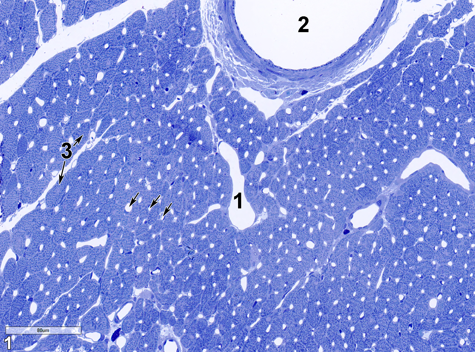 <strong>Figure 1.</strong> A toluidine blue O-stained section (0.5 micrometer thick) of cardiac muscle. The lumen of a vein (1) with a single endothelium cell layer lining contrasts with the lumen of an artery (2), again lined with a single endothelial cell layer, but then subtended with smooth muscle cells and connective tissue. Numerous small capillaries lined with a single endothelial cell layer are visible (arrows). Cardiac myocytes (3, double arrows) are seen in cross section. 25x.
