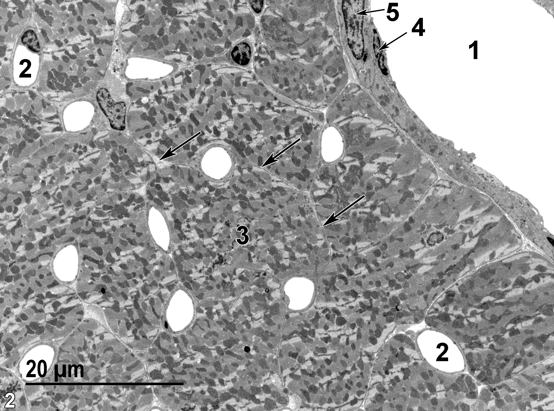 <strong>Figure 2.</strong> An ultrastructural image of cardiac muscle with a vein in the upper right (1) and a number of capillaries (2) seen in cross section. Myocyte cell (3) boundaries are defined by the endomysial space between them (arrows). Note the elongated central nucleus (5) of a smooth muscle cell and the elongated nucleus of an endothelial cell (4). 1900x.