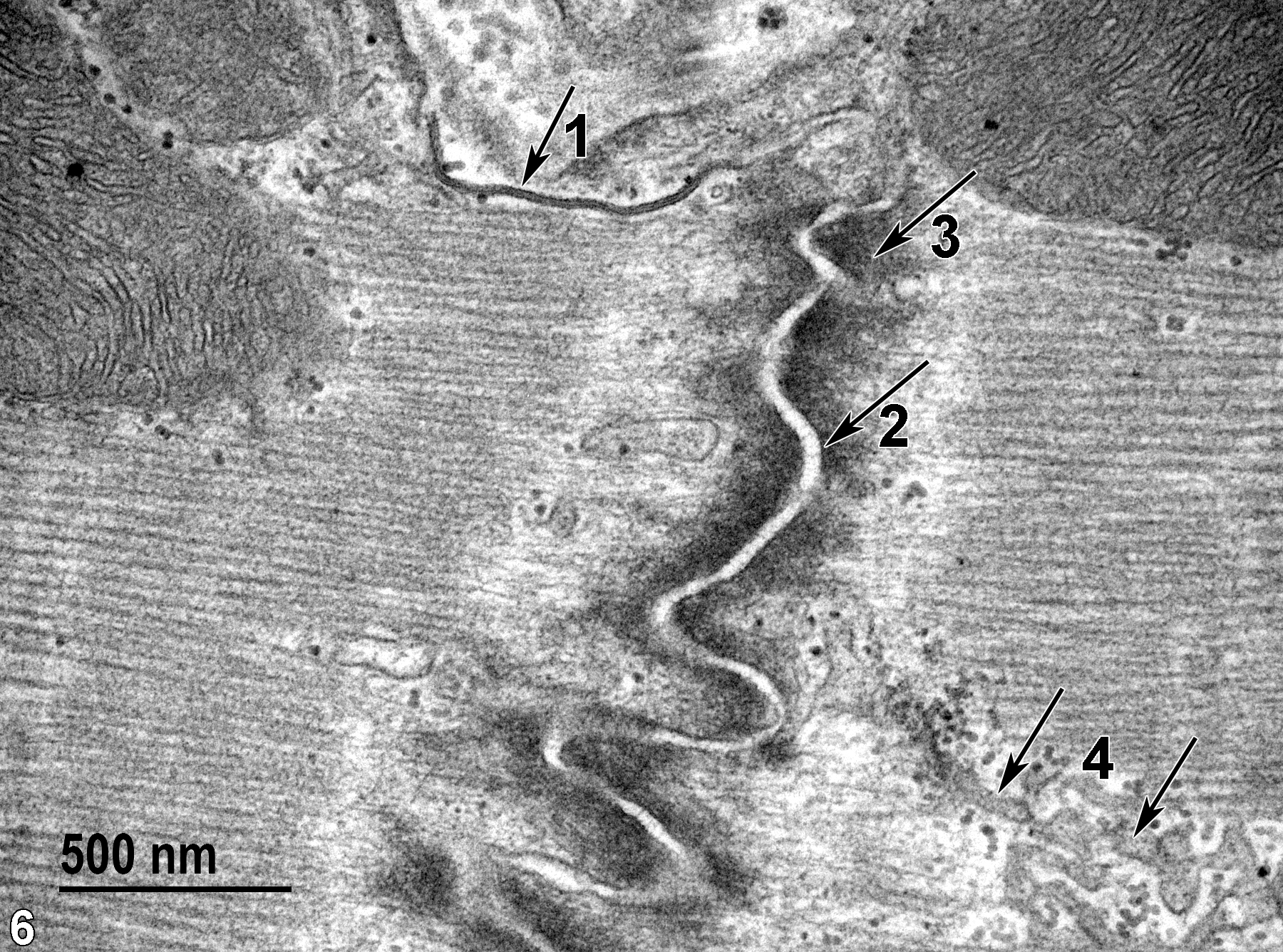 <strong>Figure 6.</strong> A higher magnification of an intercalated disk clearly showing a nexus or gap junction (1) running down the edge of the longitudinal axis of the sarcomere (arrow). As in the previous image, most of the intercalated disk is composed of fascia adherens (2, arrow) with associated webs of fine cytoplasmic filaments (3, arrow). Some of the sarcoplasmic reticulum can be seen (4, arrows). 49000x.
