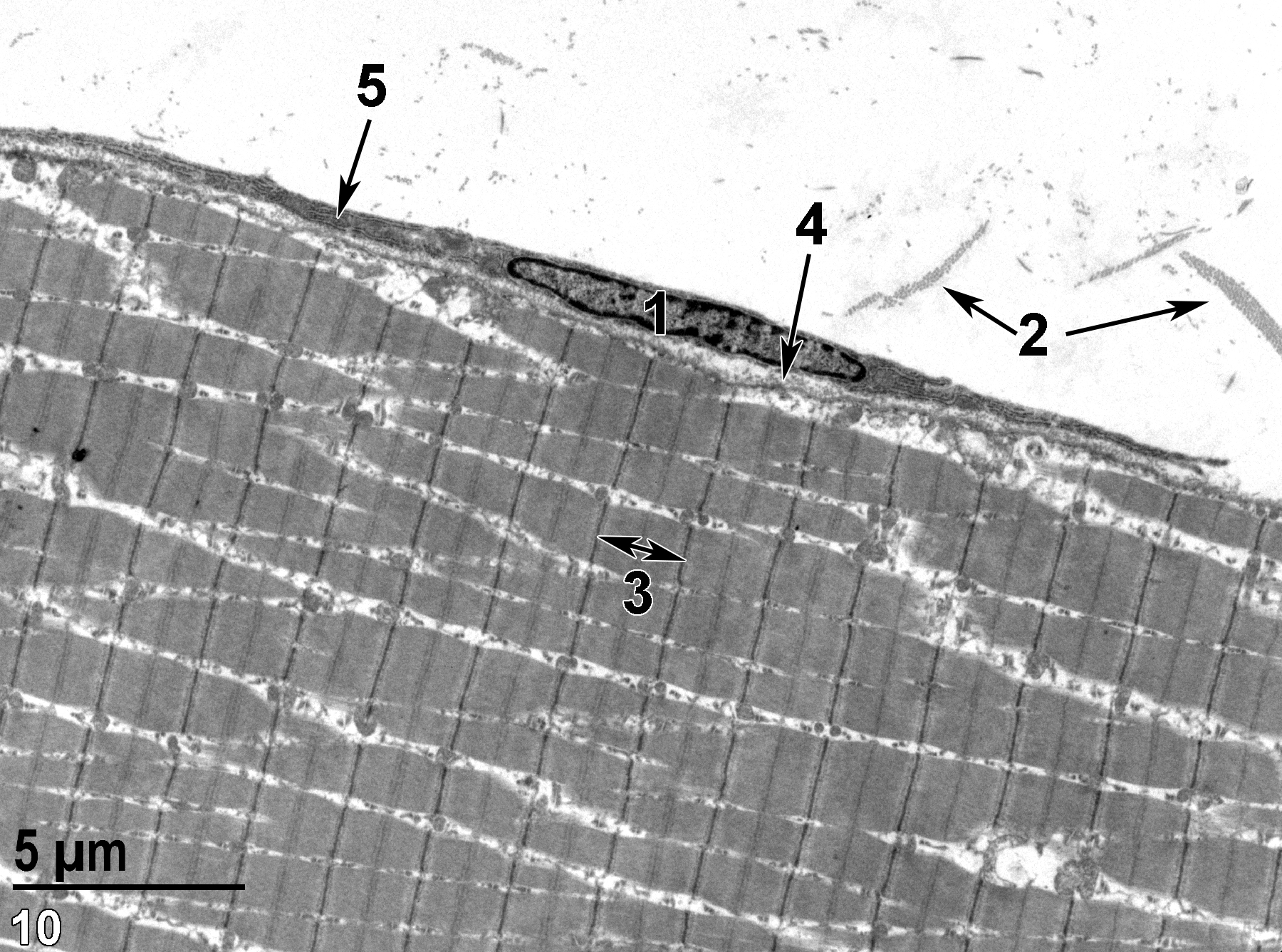 <strong>Figure 10.</strong> An ultrastructural image of a longitudinal section of skeletal muscle cell with a fibroblast (1) outside the sarcolemma. Collagen is located in the perimysium (2, double arrows) and also in the endomysium (4, arrow) beneath the fibroblast. The fibroblast contains an abundant rough endoplasmic reticulum (5, arrow). A single sarcomere (3, double-headed arrow) is shown. 4800x.