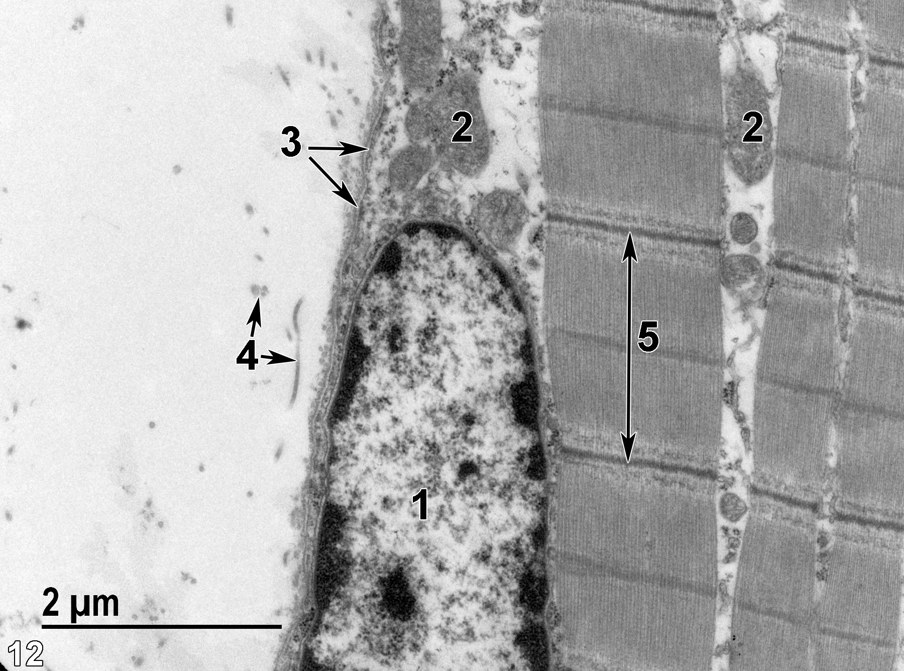 <strong>Figure 12.</strong> A higher magnification view of the periphery of a myocyte showing part of a myocyte nucleus (1) and mitochondria (2) between the myofibrils and just inside the myocyte sarcolemma and basal lamina (3, double arrows). Collagen (4, double arrows) is located just outside of the basal lamina. A single sarcomere (5) bounded by its Z lines (long double-headed arrow). 18500x.