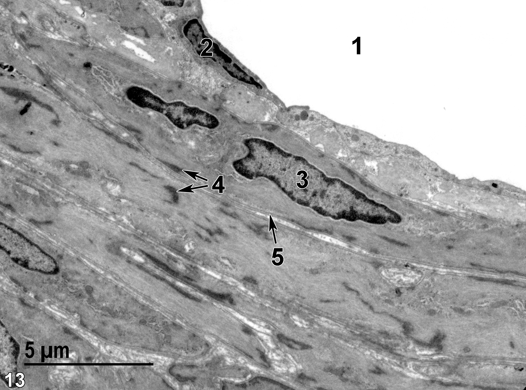 <strong>Figure 13.</strong> The lumen of an artery (1) lined with an endothelial cell layer, with one elongated endothelial nucleus (2). Beneath the endothelial cell layer are several layers of smooth muscle cells that also have elongated nuclei (3). The cytoplasm of the smooth muscle cells is filled with proteinaceous filaments and electron dense patches of alpha-actinin (4, double arrows). The individual smooth muscle cells (5) are surrounded by a basal lamina (arrow). 6800x.