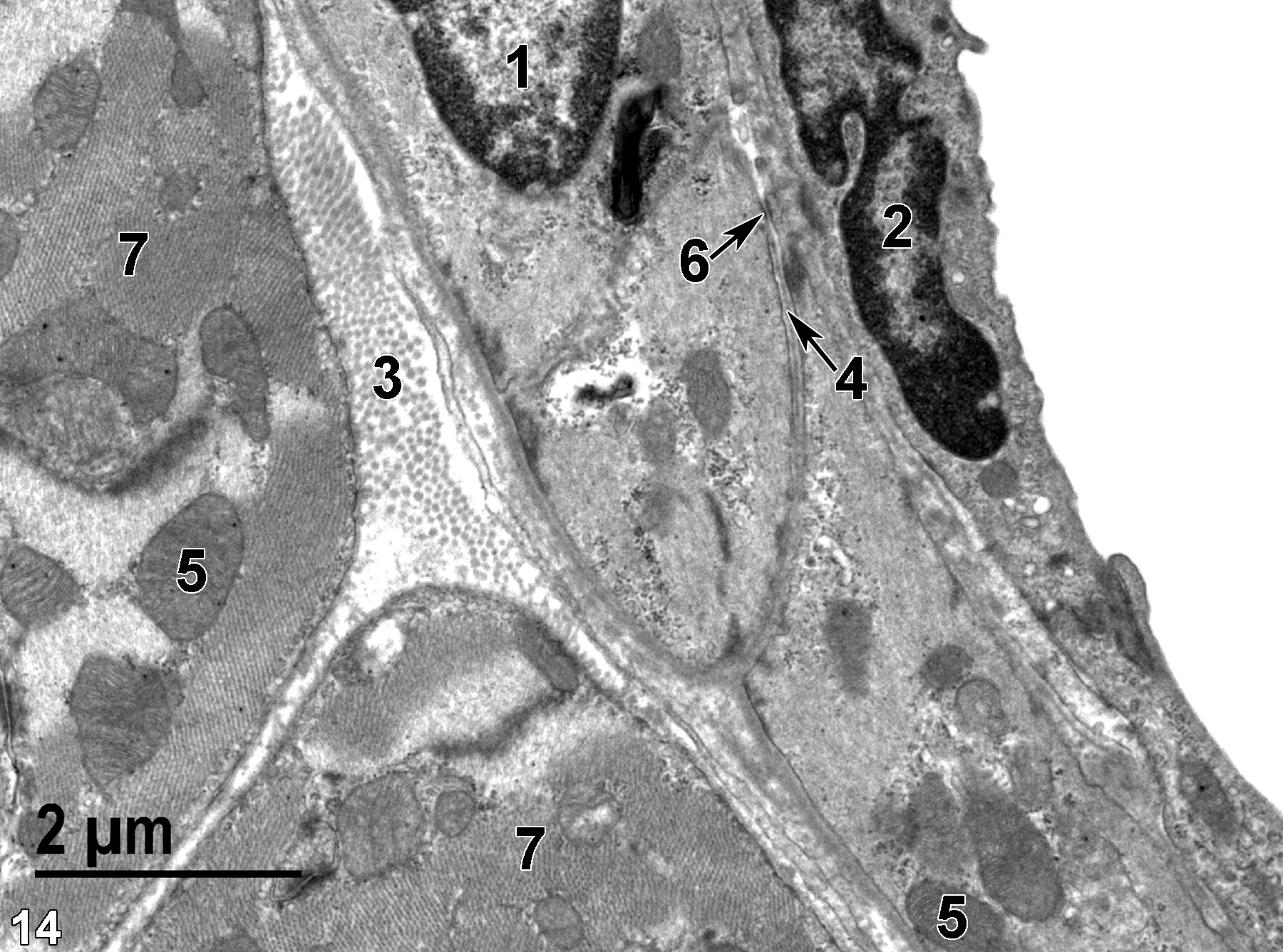 <strong>Figure 14.</strong> An image of a vein showing part of a nucleus (1) of a smooth muscle cell in a single layer of smooth muscle cells. The basal lamina (4, arrow) surrounds the smooth muscle cell, except where a desmosome (6, arrow) has formed with a thin extension of an adjacent smooth muscle cell. A pocket of collagen fibrils (3) lies between the smooth muscle cell layer and the adjacent striated cardiac muscle cells. The elongated nucleus (2) of an endothelial cell is shown lining the vein. Mitochondria (5) are less abundant in the smooth muscle cells than those in the adjacent striated cardiac myocytes (7). 11000x.