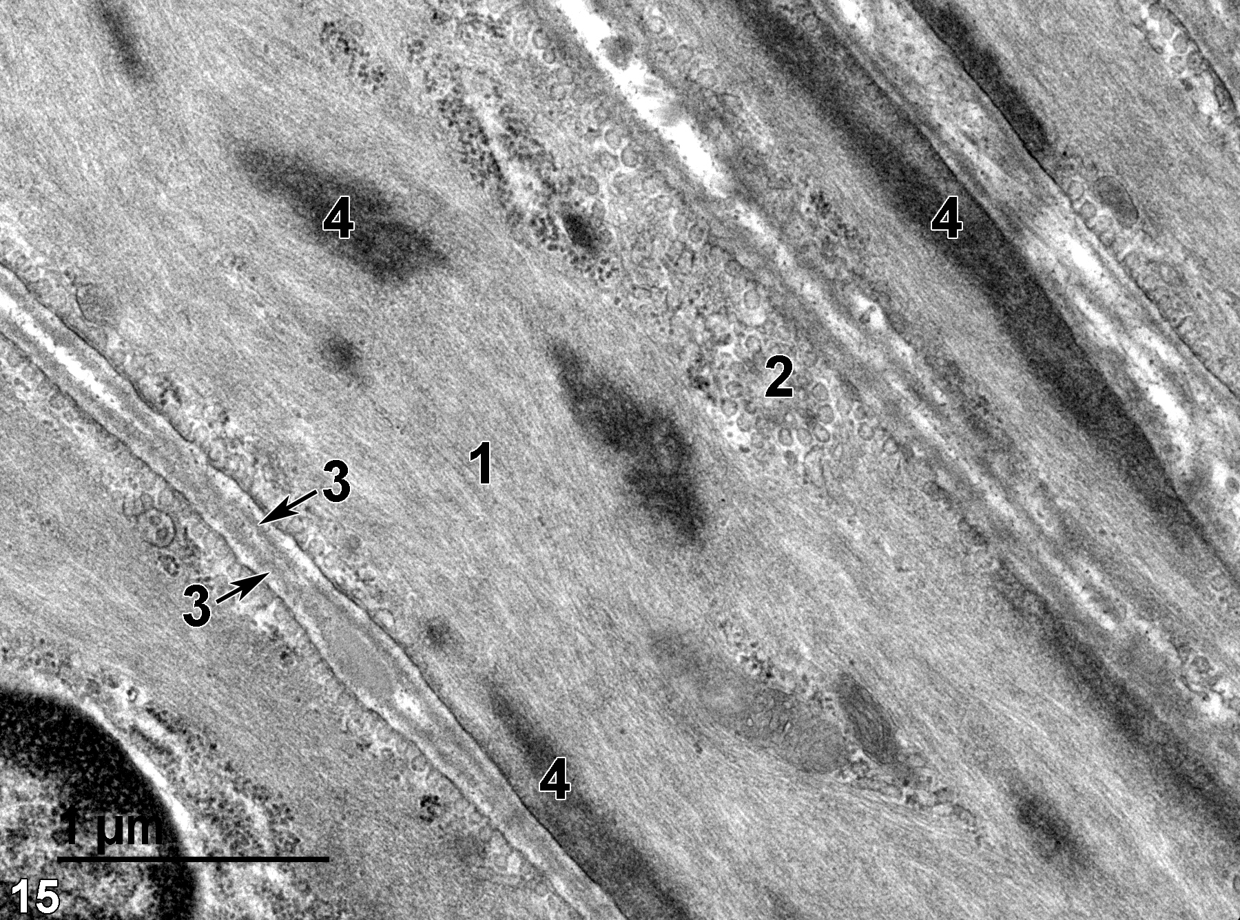<strong>Figure 15.</strong> A high-magnification view of smooth muscle cells showing proteinaceous filaments (1) largely filling the cytoplasm of these cells. Clusters of vesicles (2) beneath the smooth muscle cell membrane are characteristic of smooth muscle cells. Each smooth muscle cell is enrobed with a basal lamina (3, arrows) and contains cytoplasmic densities (4) composed of alpha-actinin. 30000x.