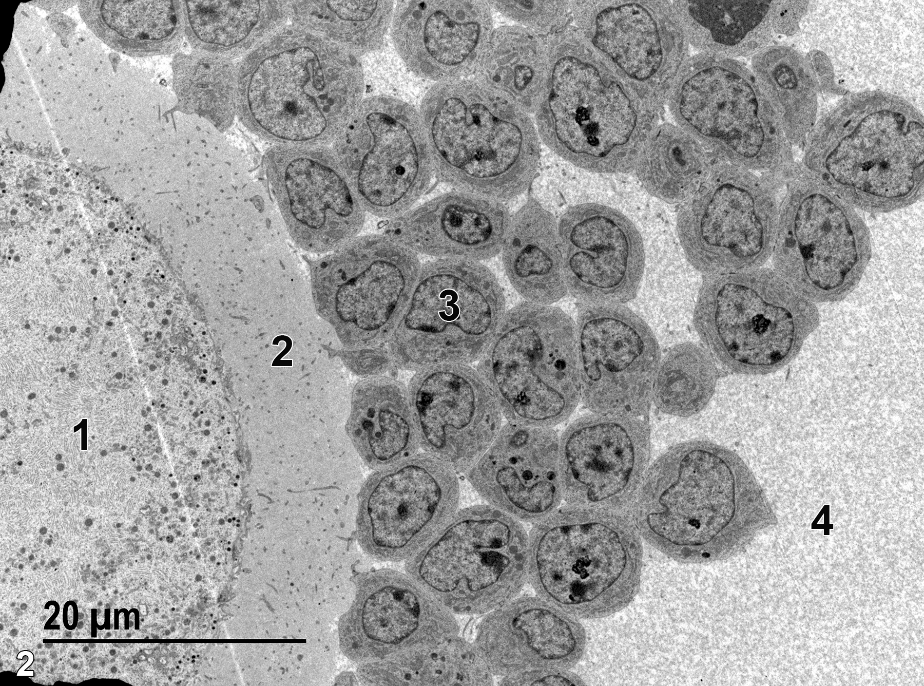 <strong>Figure 2.</strong> A low magnification electron micrograph of a secondary oocyte. Surrounding the secondary oocyte (1) is the zona pellucida (2), which consists of mucopolysaccharides with numerous secondary oocyte microvilli ramifying through the matrix. A nucleus of a follicular cell (3) in the corona radiata is shown. The spaces between follicular cells is filled with follicular fluid (4), known as liquor folliculi. 1900x.