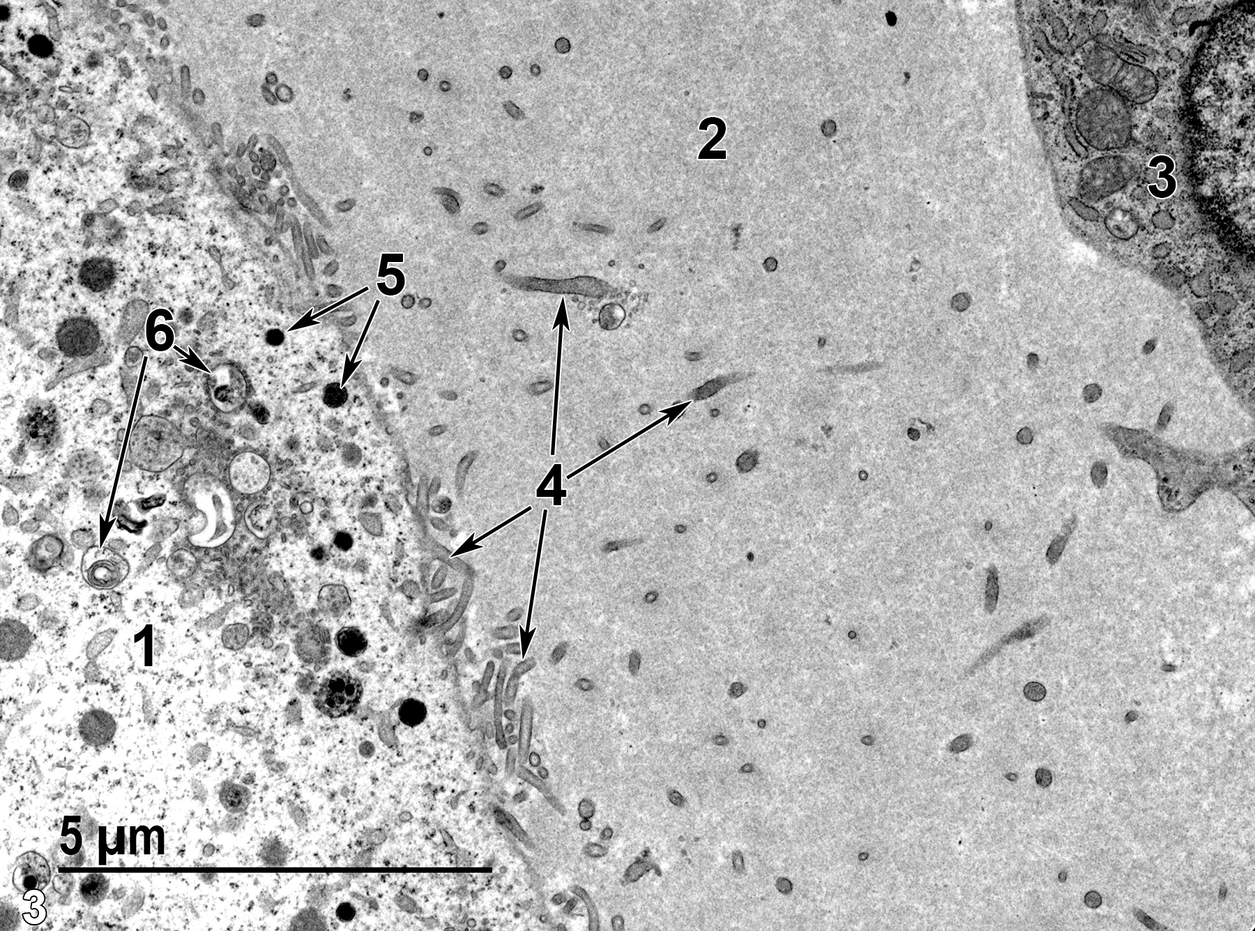 <strong>Figure 3.</strong> An enlarged view of part of the oocyte (1), zona pellucida (2), and part of a follicular cell (3). The zona pellucida consists of a finely fibrillar material (mucopolysaccharide) penetrated by numerous microvilli (4, arrows) that originate from the surface of the secondary oocyte. The secondary oocyte contains cortical granules (5, arrows) and lysosomes (6, arrows). 9300x.