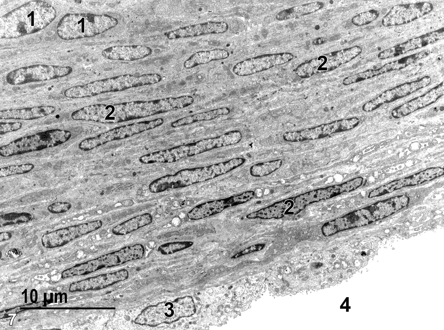 <strong>Figure 7.</strong> A low magnification view of the edge of the theca interna underlain by the theca externa and a layer of endothelial cells of a vessel. Both the theca interna and theca externa consist of squamous cells and collagen bundles. Theca interna cells (1) are thicker and have somewhat rounded nuclei. The more flattened cells (2) of the theca externa have more elongated and flattened nuclei. The thin basal lamina of the theca externa lying between the most basal cells and the endothelial cells (3) lining a blood vessel (4) is not evident in this micrograph. 2900x.