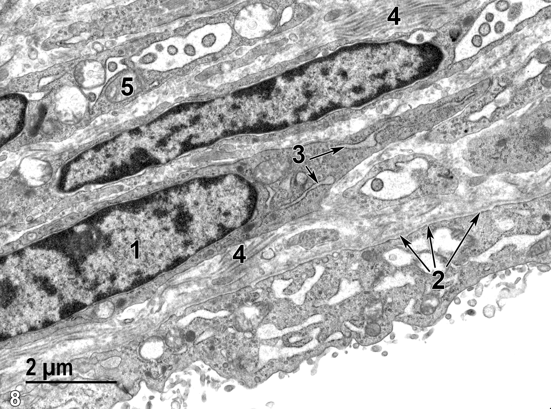 <strong>Figure 8.</strong> An enlarged view of part of the theca externa layer of Figure 7. The elongated nuclei (1) of the squamous cells have marginated electron-dense heterochromatin. The cells also contain prominent rough endoplasmic reticulum (3, arrows). The thin basal lamina (2, arrows) of the follicle is obvious at this magnification. Collagen bundles (4) are visible in the intercellular spaces. A mitochondrion (5) is shown. 11000x.
