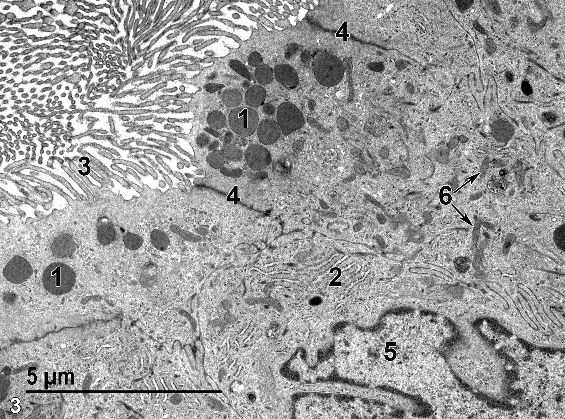 <strong>Figure 3.</strong> A higher magnification view of epithelial cells that show secretory granules (1), accumulations of rough endoplasmic reticulum (2), microvilli (3) lining the ampulla lumen, junctional complexes (4) between adjacent epithelial cells, a single nucleus (5), and mitochondria (6, arrows). 9300x.