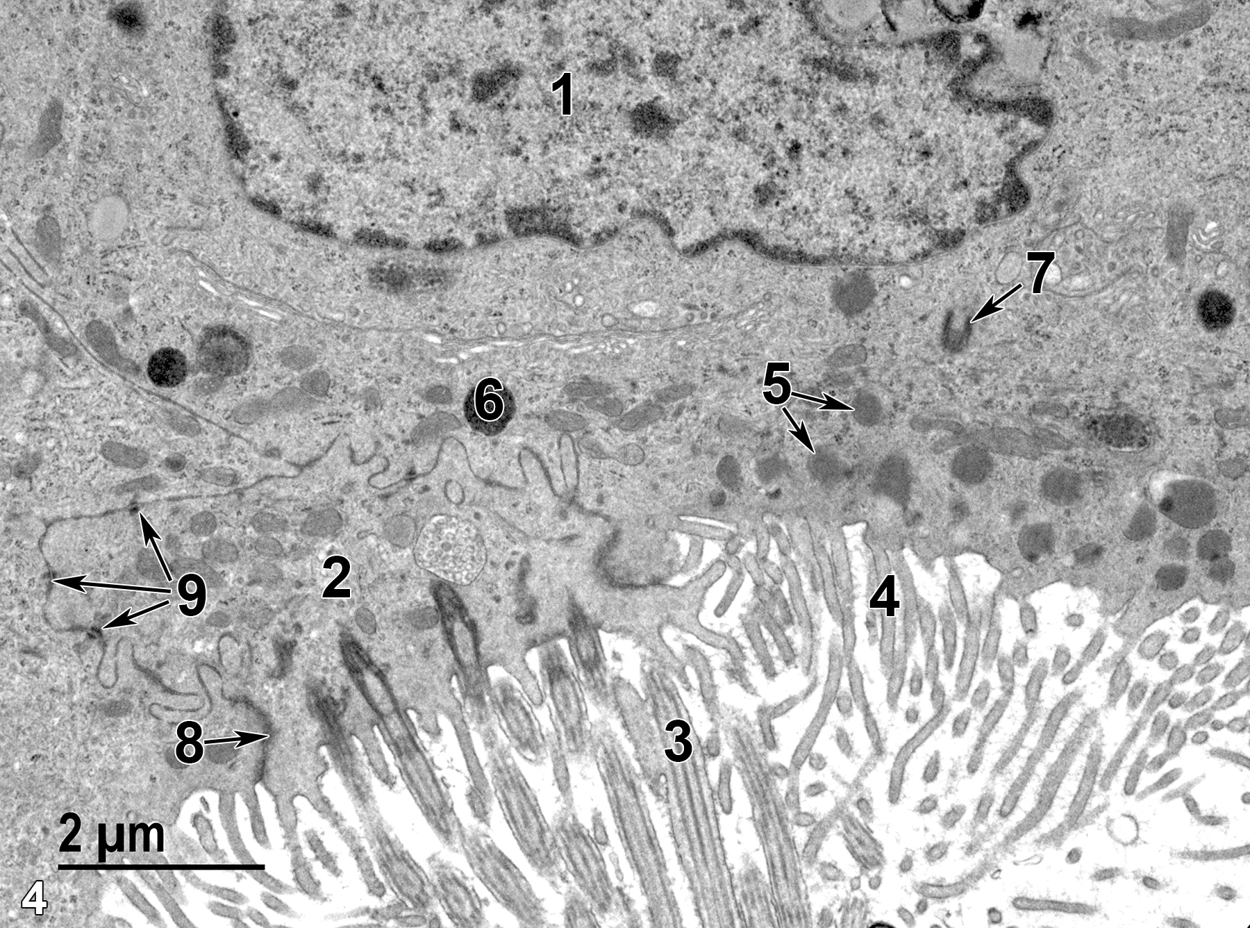 <strong>Figure 4.</strong> A view of the ampulla epithelial surface, lined with both a ciliated cell (2) with cilia (3) at the surface, next to two secretory cells that only have microvilli (4) at their surfaces. Within a secretory cell is a secretory granule (6), mitochondria (5, arrows), a single centriole (7, arrow) and a nucleus (1). A junctional complex (8, arrow) binds the apical borders of two adjacent cells. Desmosomes (9) also hold the borders of adjacent cells together (arrows). 11000x.