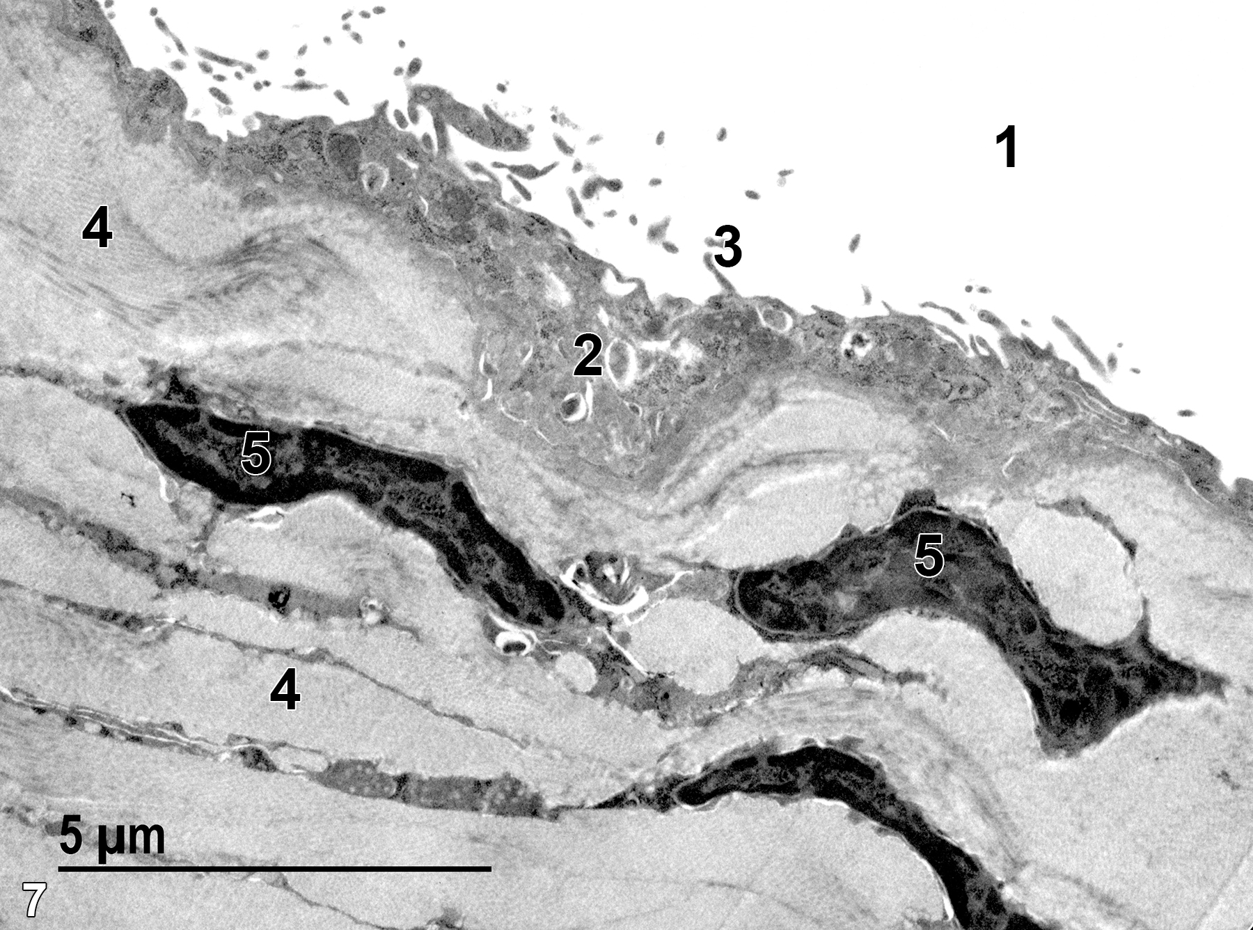 <strong>Figure 7.</strong> A higher magnification image of Figure 6. The peritoneal cavity (1) lies just outside of the thin squamous epithelium (2), which has short microvilli (3) on the surface of the epithelial cells. Bundles of collagen fibrils (4) with embedded fibroblasts (5) make up the serosal matrix. 9300x.