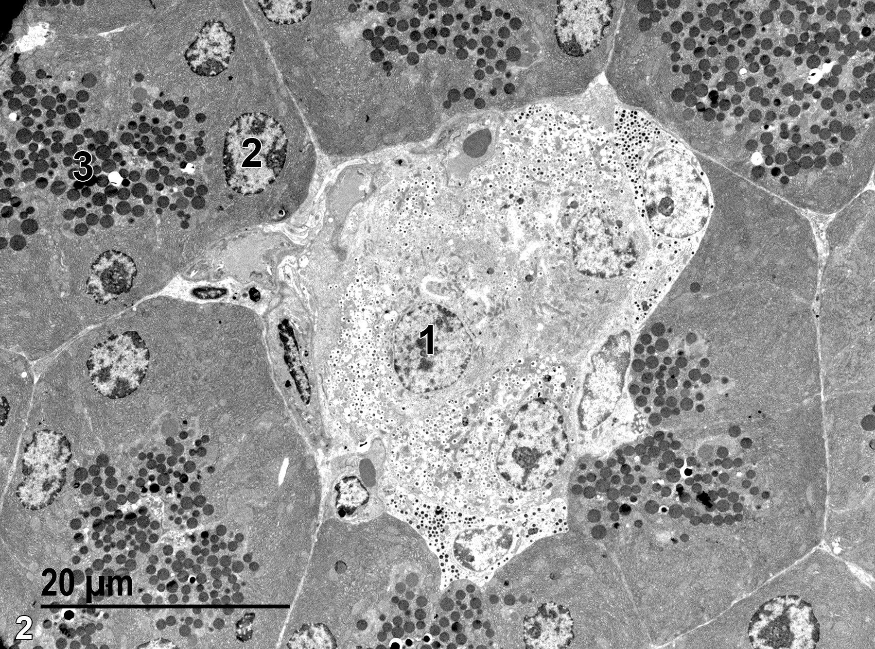 <strong>Figure 2.</strong> A low magnification electron microscope image of the same area shown in Figure 1. The less electron-dense area in the center is an Islet of Langerhans, with one of the endocrine cell nuclei (1) shown. A nucleus located near the base of an acinar epithelial cell (2) is located beneath the more apical zymogen granules (3). 1900x.