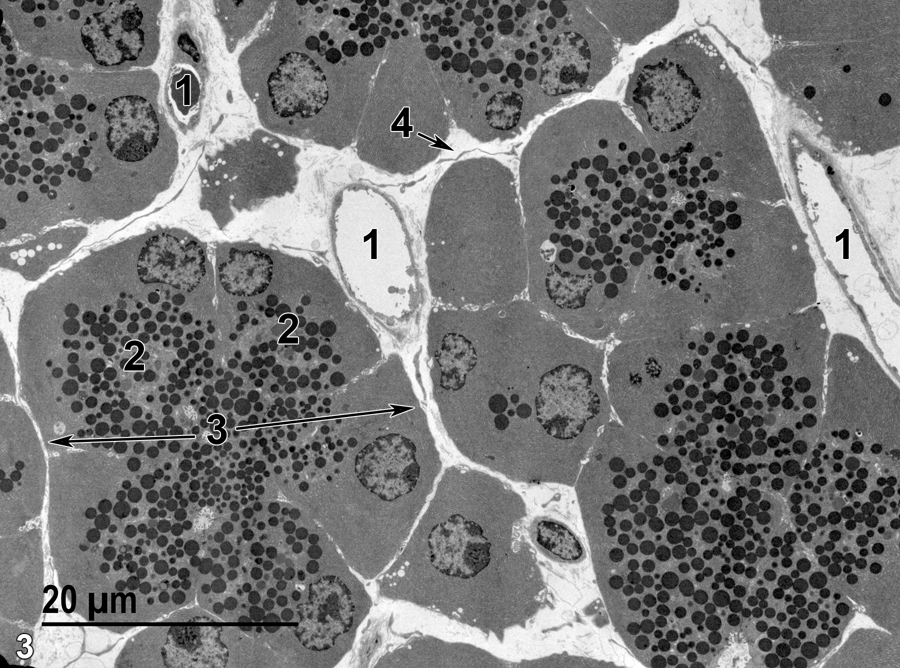 <strong>Figure 3.</strong> A higher magnification view of the parenchymal tissue showing capillaries (1) in the septal areas separating the acini (3, double arrows). Individual acinar glandular epithelial cells (2) have basal nuclei and apical zymogen granules and are arranged around acinar lumens. Some elements of connective tissue of an intralobular septum (4) can be seen between the lobules, which are composed of collections of acini. 1900x.