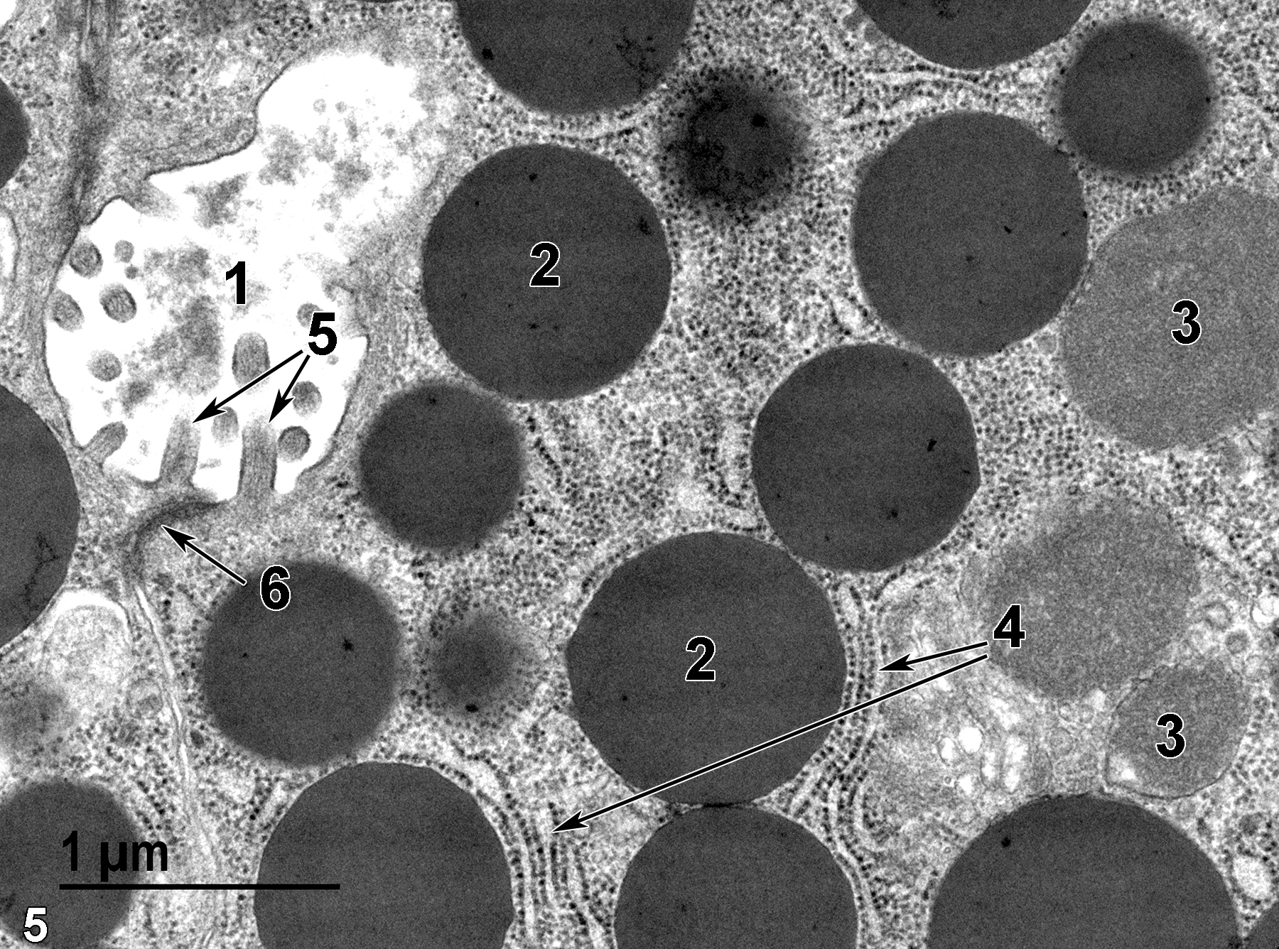 <strong>Figure 5.</strong> The highest magnification view of the apical region of parenchymal epithelial cells showing the acinar lumen (1), zymogen granules (2), mitochondria (3), rough endoplasmic reticulum (4, short and long arrows), microvilli of the epithelial cells extending into the acinar lumen (5, double arrows), and a junctional complex between adjacent epithelial cells (6, arrow). 30000x.