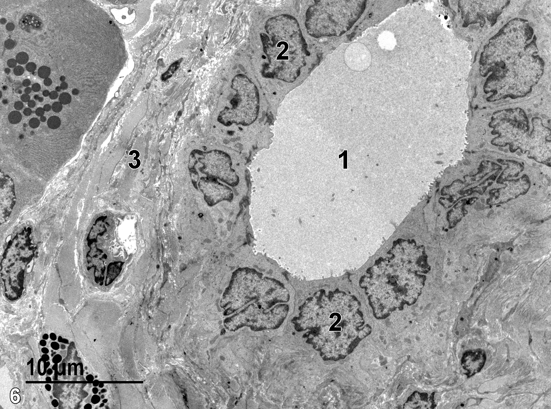 <strong>Figure 6.</strong> The intralobular duct lumen (1) contains some finely flocculent material and has short microvilli from the duct cells protruding into the lumen. The duct is composed of a single layer of low cuboidal epithelial cells, each with a single nucleus (2). An interlobular septum (3) contains bundles of collagen that appear as homogeneous gray areas at this magnification. 2900x.