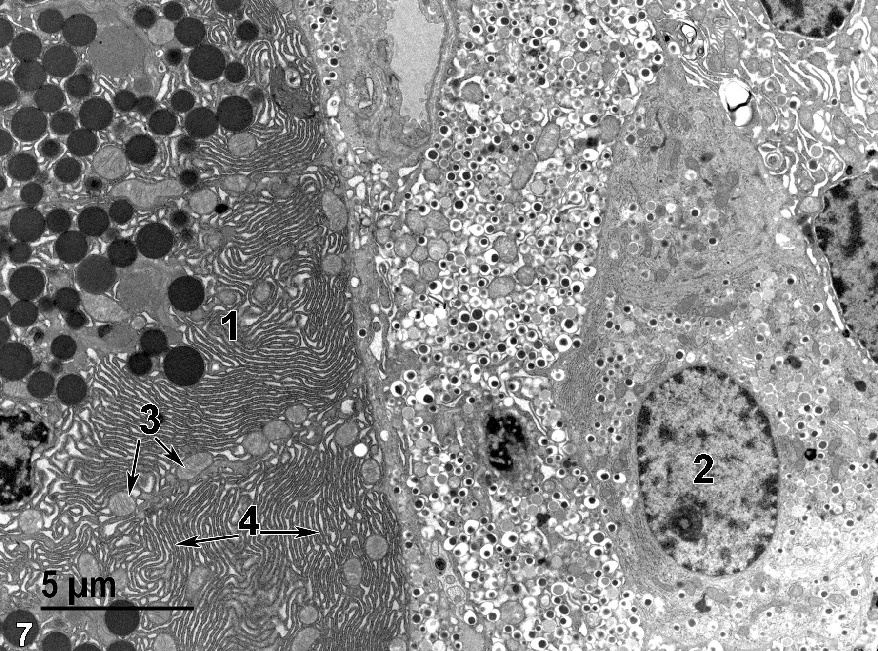 <strong>Figure 7.</strong> A glandular epithelial cell of the parenchyma (1) to the left, containing masses of rough endoplasmic reticulum (4, double arrows) and mitochondria (3, double arrows) in addition to the electron dense zymogen granules. To the right is the edge of the less electron-dense endocrine cells of an Islet of Langerhans. The nucleus (2) of one of the endocrine cells is labeled. 4800x.