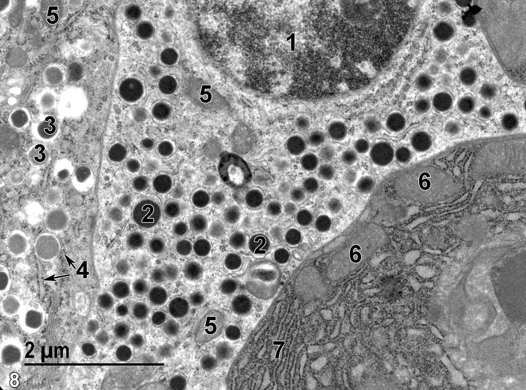 <strong>Figure 8.</strong> An alpha cell (glucagon cell) nucleus (1). Note the characteristic electron-dense granules (2) with little space between the granule membrane and contents, and the mitochondria (5). The cell to the lower right of the image is part of an exocrine cell containing large amounts of rough endoplasmic reticulum (7) and a few mitochondria (6). The typical zymogen granules and nucleus of the cell are out of the plane of section. The cell to the far left of the image is a beta cell (insulin cell) with variably electron-dense granules (3) with a core typically separated from the membrane by a clear space. Elements of rough endoplasmic reticulum (4, double arrows) are evident. 18500x.
