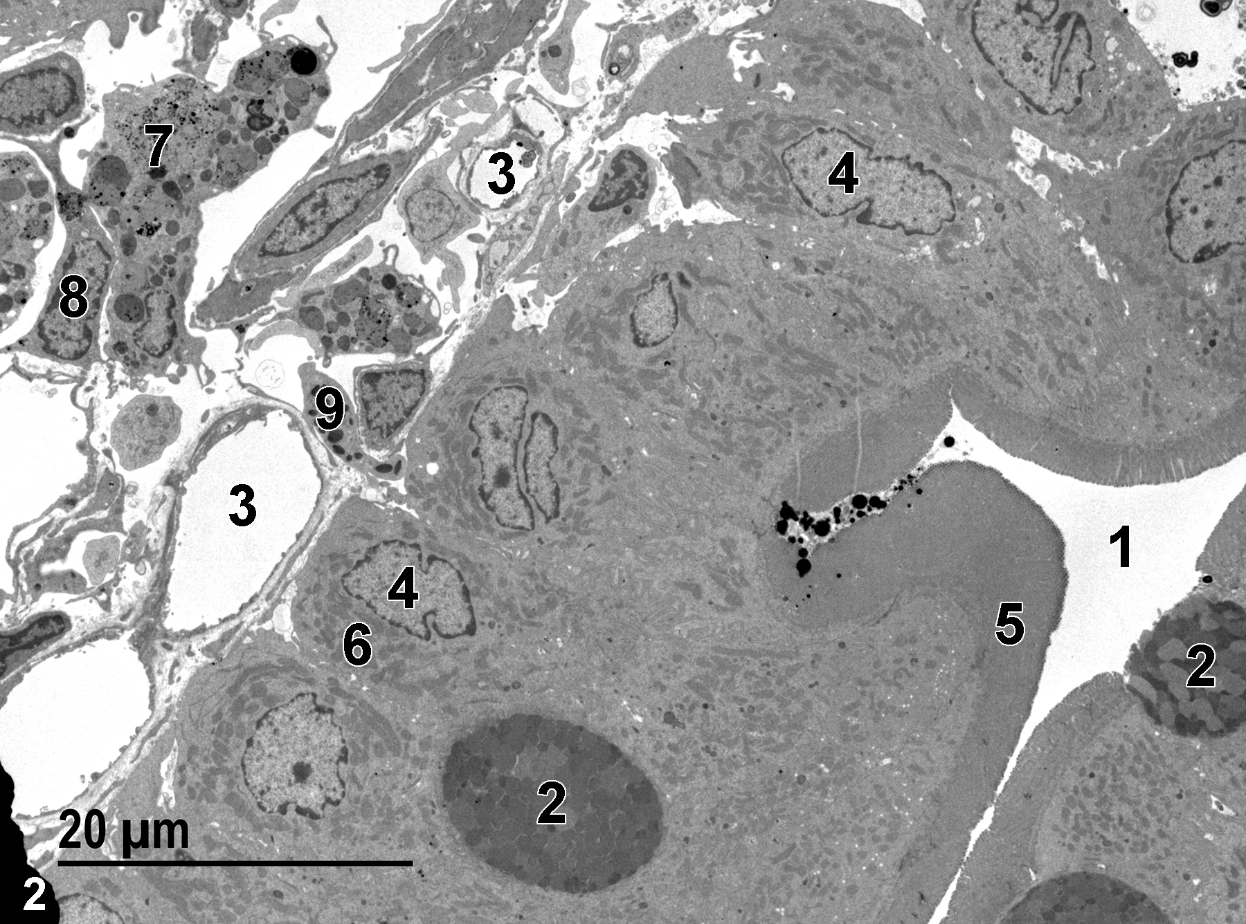 <strong>Figure 2.</strong> The duodenal lumen (1) lined with absorptive columnar epithelial cells with basal nuclei (4), surface microvilli (5), and numerous mitochondria (6). Occasional mucous (goblet) cells (2) containing mucous droplets are present. Capillaries (3) are present in the lamina propria, along with macrophages (7), fibroblasts (8), and an eosinophil (9). 1900x.