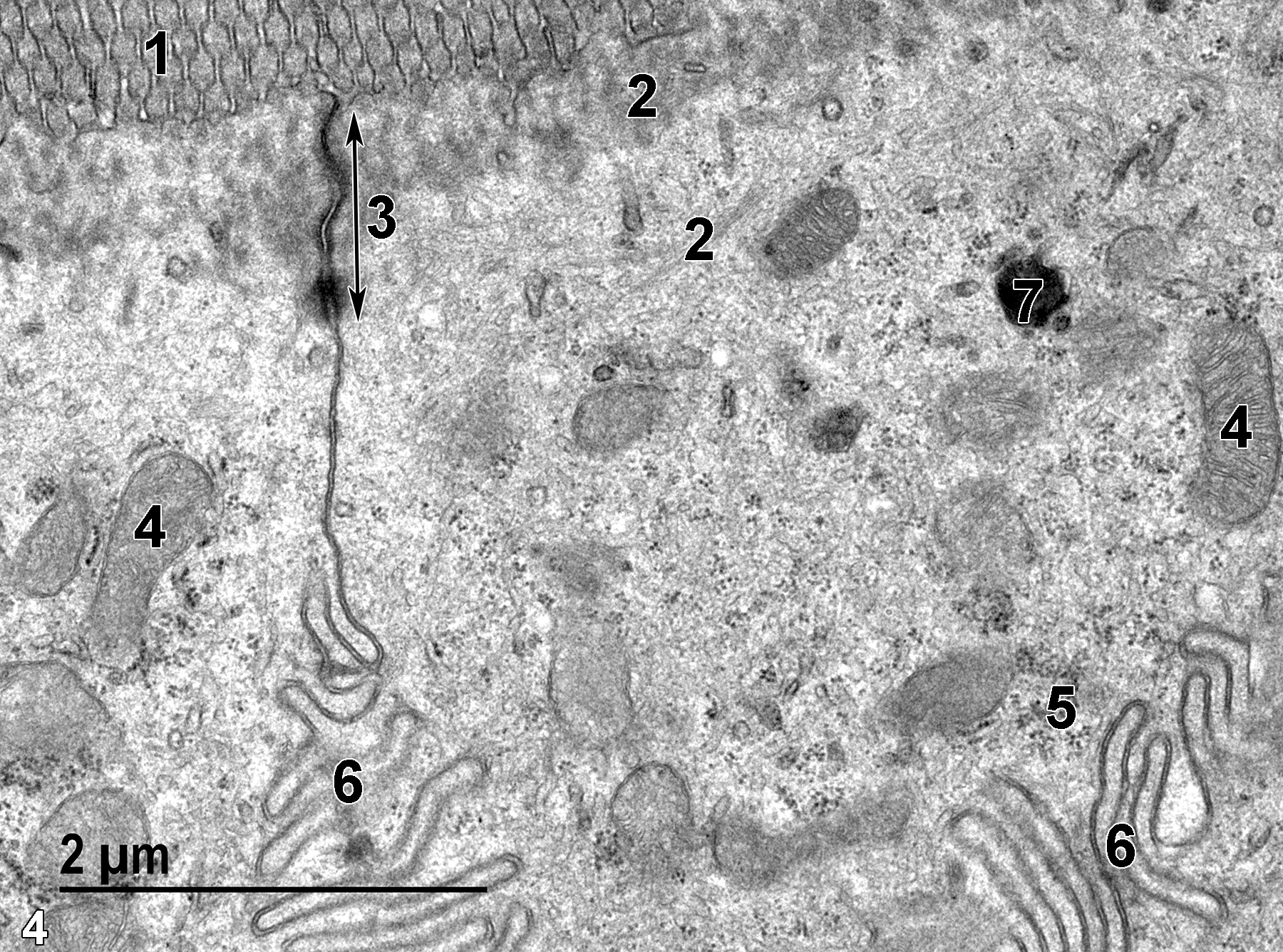 <strong>Figure 4.</strong> A higher magnification view of an absorptive cell. The microvilli at the cell surface (1) have fibrous terminal web material (2) at their base, with some of the proteinaceous fibrils extending some distance into the cytoplasm below the terminal web. A junctional complex (3) terminating in a desmosome (double-headed arrow) is present above the infoldings of adjacent epithelial cells (6). Free ribosome clusters (5) are present in the cytoplasm, along with mitochondria (4) and a lysosome (7). 23000x.