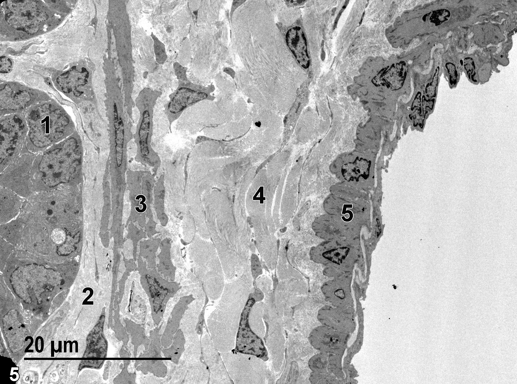 <strong>Figure 5.</strong> The base of a villus with a single epithelial cell nucleus labeled (1). Below the villus cells is the lamina propria (2) with primarily collagen fibrils and fibroblasts. Directly below the lamina propria is the muscularis mucosae (3) composed of smooth muscle cells and collagen fibrils between the cells. Below that layer is the submucosa (4), which consists of large amounts of collagen and sparse fibroblasts. The final layer to the right in the image is composed of smooth muscle cells (5) of the tunica muscularis. 1900x.