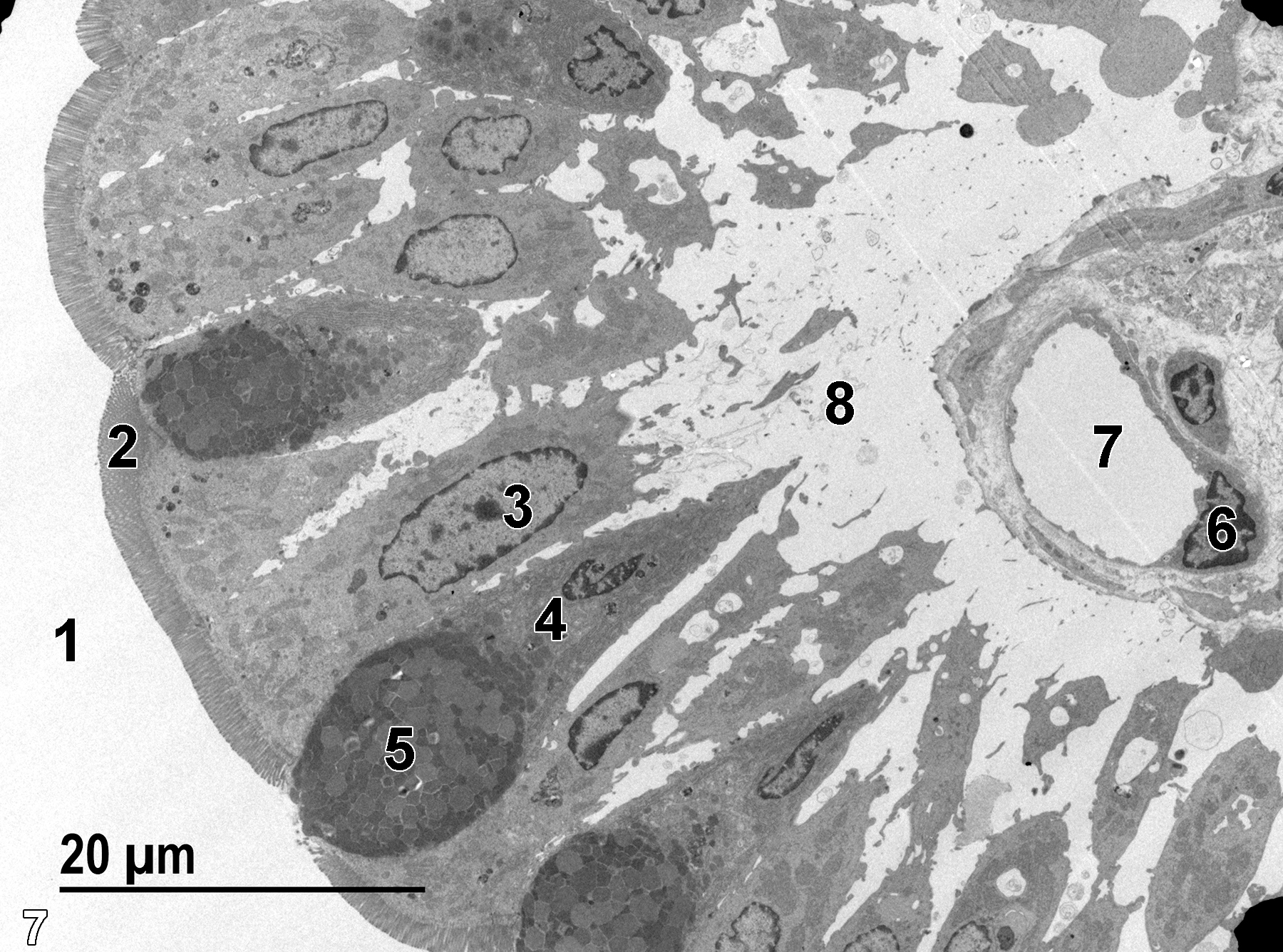 <strong>Figure 7.</strong> A low magnification electron micrograph of a villus protruding into the intestinal lumen (1). A nucleus of an absorptive cell (3) is located basally in the epithelial cell, whereas the surface of the cell has a dense covering of microvilli (2). A mucous cell (4) contains a mass of mucous droplets (5) near the luminal surface. The interior of the villus (8) contains a capillary bed with surrounding connective tissue. A single capillary lumen (7) with a thin endothelial lining and a single nucleus (6) are shown. 1900x.