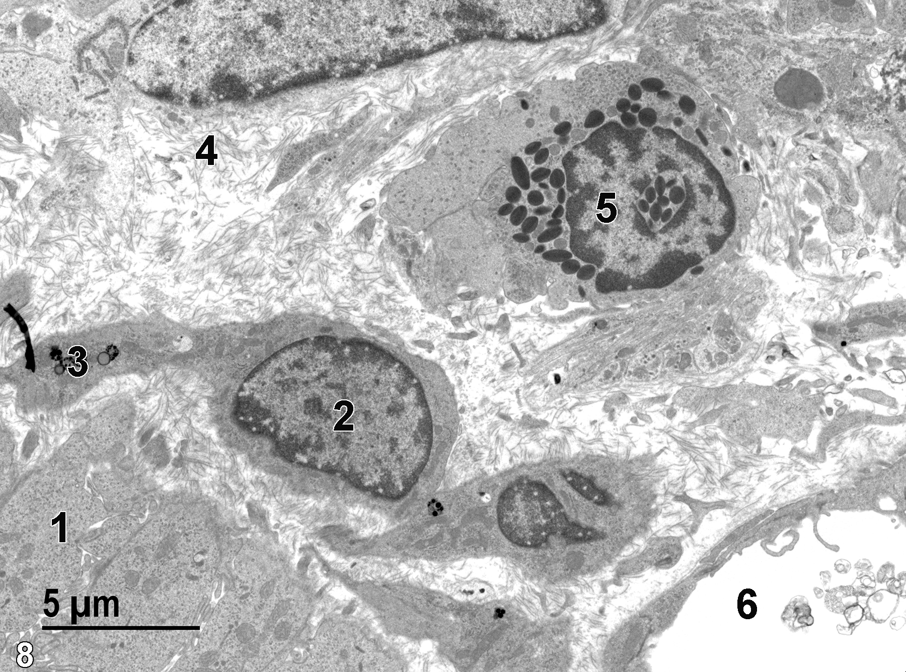 <strong>Figure 8.</strong> A higher magnification view of the lamina propria (1) beneath the epithelial cells of a villus, showing a fibroblast nucleus (2) and lysosomes (3) in the fibroblast cytoplasm. The lamina propria also contains numerous collagen fibrils (4) and a single eosinophil (5) with characteristic specific granules that have a lenticular shape. A single blood vessel (6) containing membranous debris is shown. 4800x.