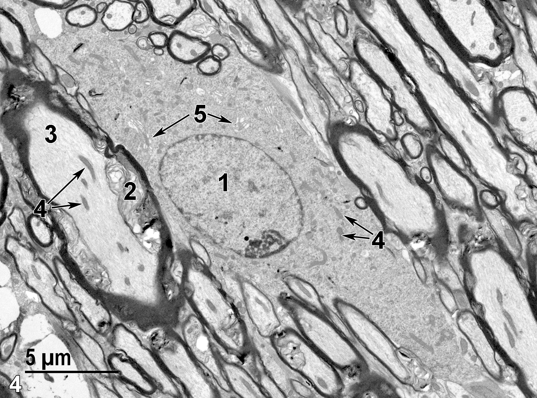 <strong>Figure 4.</strong> A higher magnification of a perikaryon, showing the round nucleus (1) with a single peripheral nucleolus and little heterochromatin. The cytoplasm has mitochondria (4, arrows) and Golgi bodies (5, arrows) that are visible at this magnification. The myelinated axon (3) has a few mitochondria (4, arrows). The disorganized membranous layers of the myelin sheath (2) are a fixation artifact. 4800x.