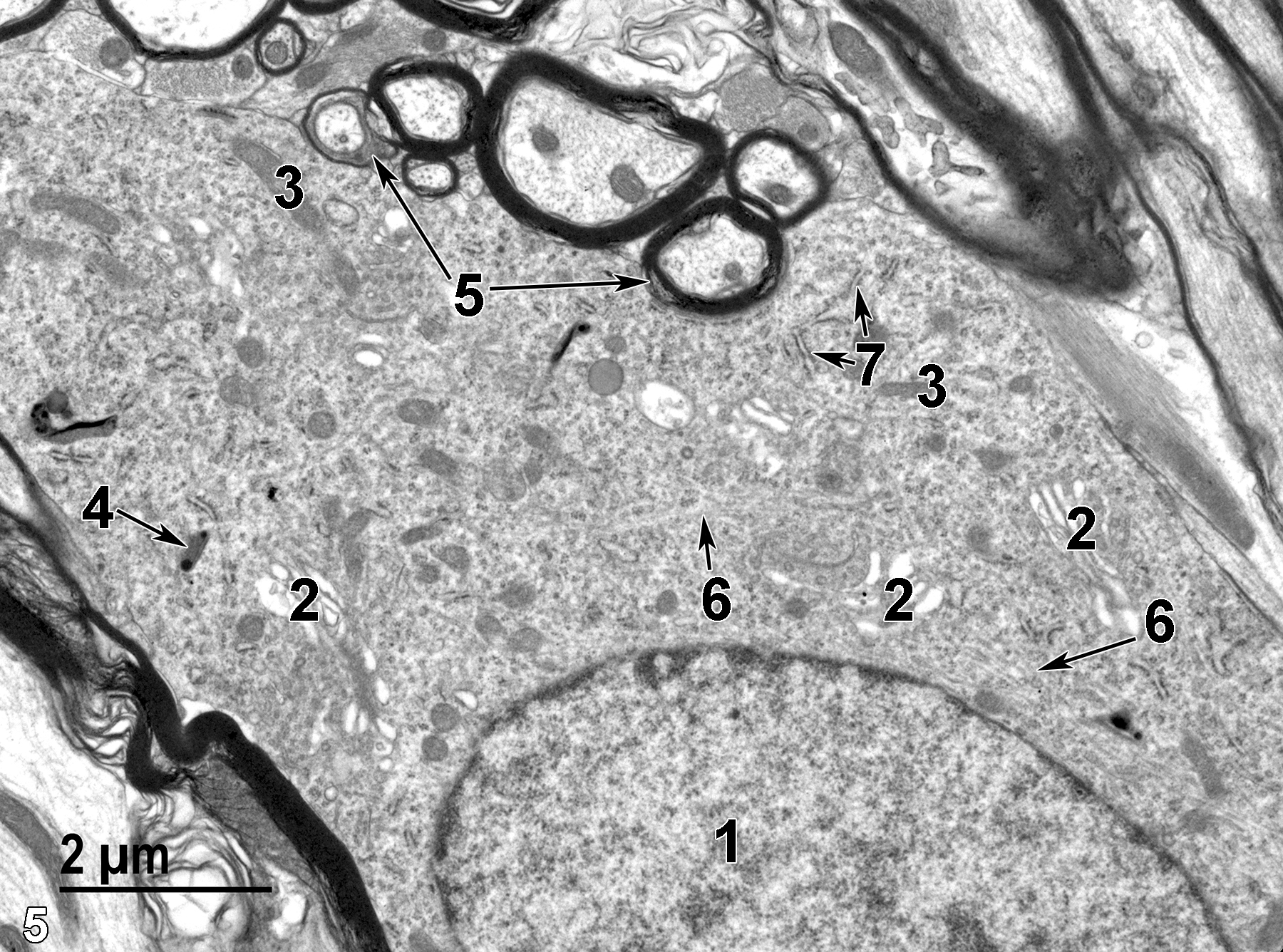 <strong>Figure 5.</strong> A higher magnification of the perikaryon seen in Figure 4. The nucleus (1) has closely associated Golgi bodies (2) and bundles of intermediate filaments (6, arrows). Mitochondria (3) are relatively numerous. One lysosome is present (4, arrow). Tubular cisternae of rough endoplasmic reticulum are scattered throughout the cytoplasm (7, arrows). Densely stained myelin surrounding axons is shown (5, arrows). 11000x.