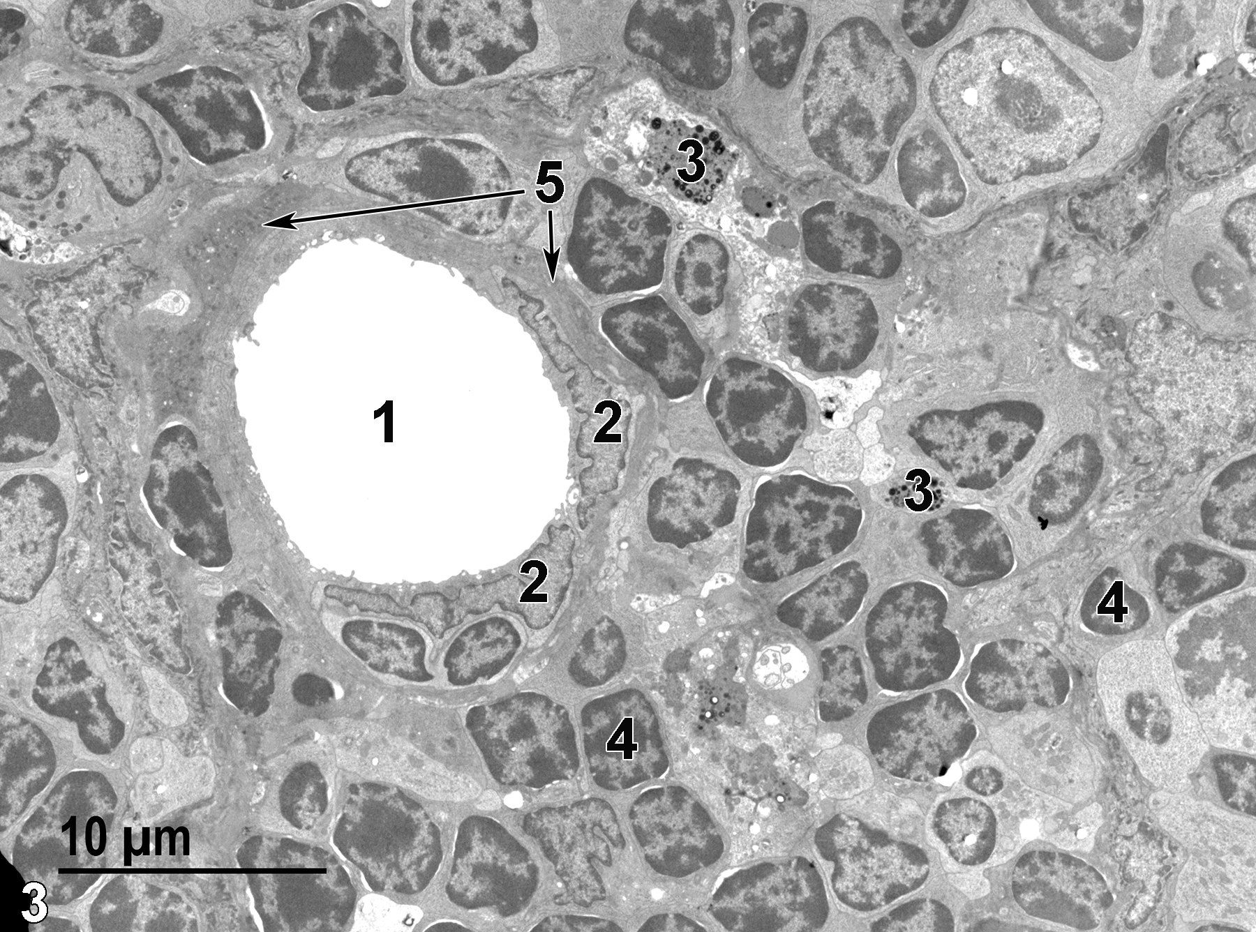 <strong>Figure 3.</strong> A low magnification ultrastructural image of the white pulp. A central arteriole lumen (1) is surrounded by endothelial cells with flattened nuclei (2), with a thin band of smooth muscle cells (5, arrows) surrounding the endothelial cells. Macrophages (3) containing lysosomes are present among the lymphocytes (4). 2900x.