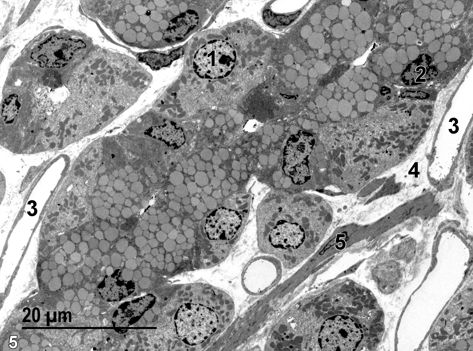 <strong>Figure 5.</strong> A low magnification view of the glandular stomach near the base of a gastric pit. A nucleus (1) of a parietal cell can be seen, as well as a nucleus of a chief (zymogen) cell (2). Capillaries (3) are located between the epithelial cells of the gastric pits, along with collagen fibrils (4) and one smooth muscle cell (5). 1900x.