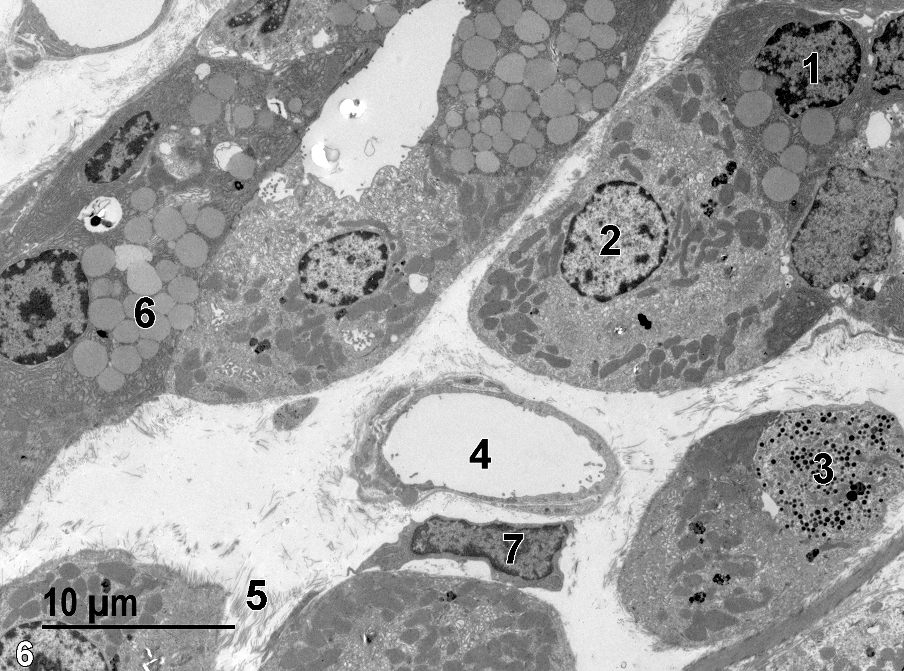 <strong>Figure 6.</strong> A view of another area in a gastric pit, with a chief cell nucleus (1) and a parietal cell nucleus (2). Chief cells contain numerous zymogen granules (6), whereas the parietal cells contain a few electron-dense lysosomes, numerous mitochondria, and vesicular profiles (intracellular canaliculi). One enteroendocrine cell (3) with small secretory granules with electron-dense content is present. A blood vessel (4) surrounded by a loose collagenous matrix (5) has a fibroblast (7) directly beneath it. 2900x.