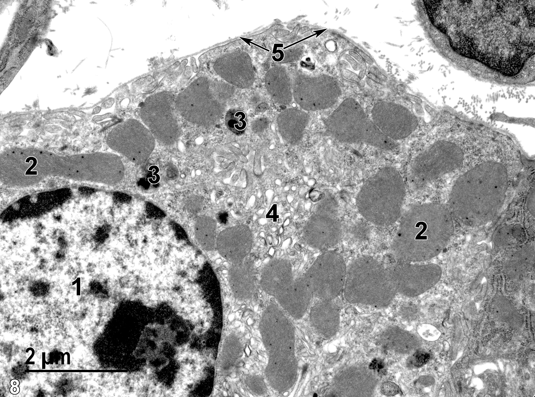 <strong>Figure 8.</strong> A view of a parietal cell. The nucleus (1) contains a single nucleolus with marginated heterochromatin. Numerous pleomorphic mitochondria (2) are present, along with small lysosomes (3) and vesicular profiles (4) of the intracellular canaliculi characteristic of this cell type. The cell has a basal lamina at its surface (5, arrows). 13000x.
