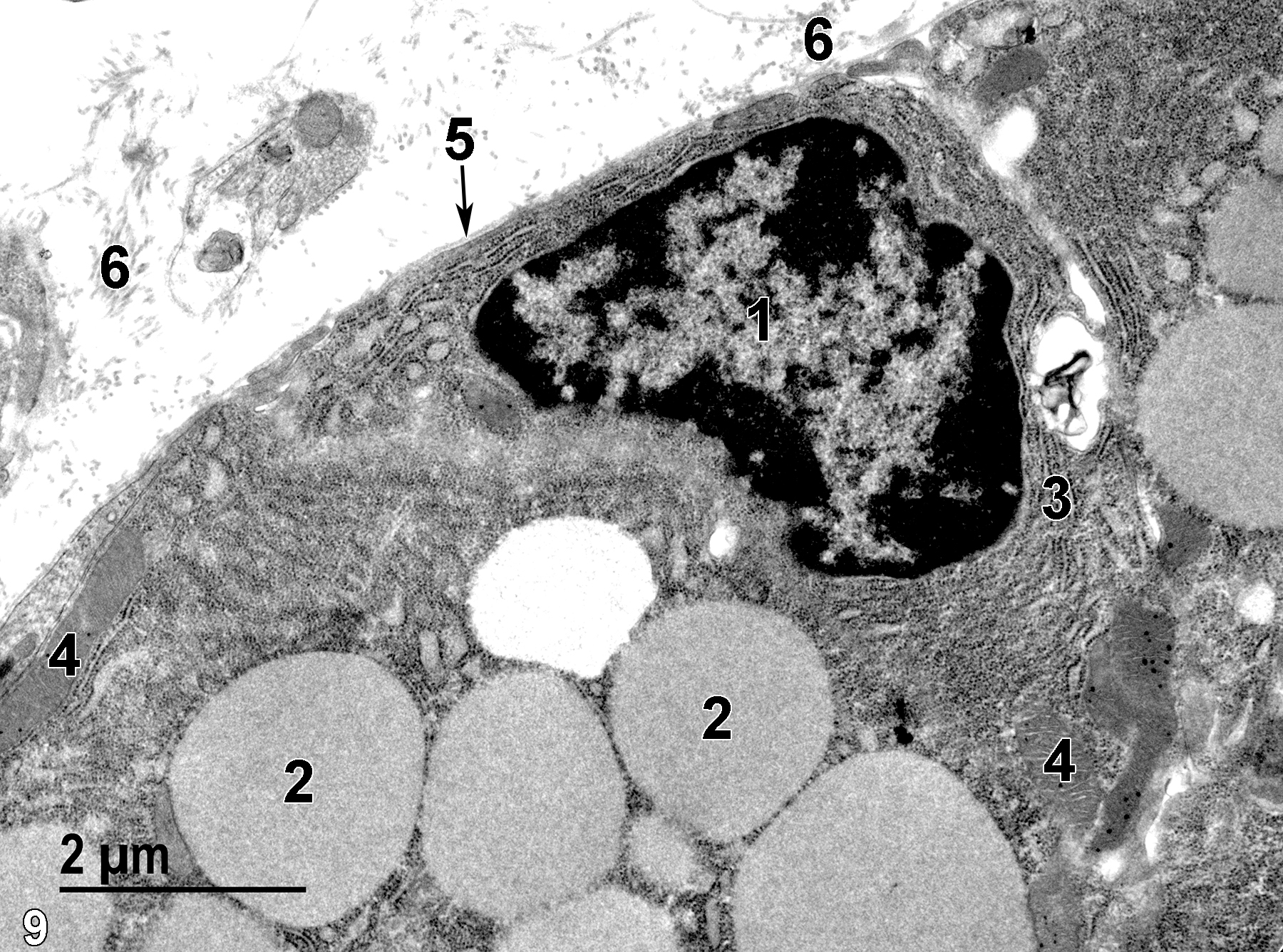<strong>Figure 9.</strong> The details of a chief cell. The nucleus (1) is surrounded by rough endoplasmic reticulum (3) elements. Large zymogen granules (2) are present, along with a few mitochondria (4). The surface of the cell is covered with a thin basal lamina (5, arrow). Bundles of collagen fibrils (6) can be seen in the gastric pit lumen. 13000x.