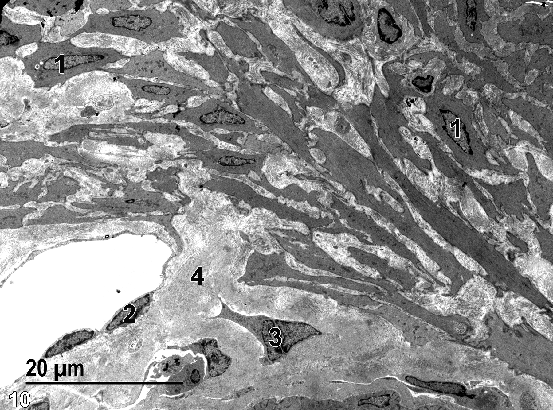 <strong>Figure 10.</strong> A low magnification view of the muscularis mucosae, with numerous elongate smooth muscle cells with elongate nuclei (1). A capillary (2) is present, lined with a thin endothelial cell layer with elongate nuclei. A small portion of the submucosa is present, composed of fibroblasts (3) and large amounts of collagen fibrils (4). 1900x.