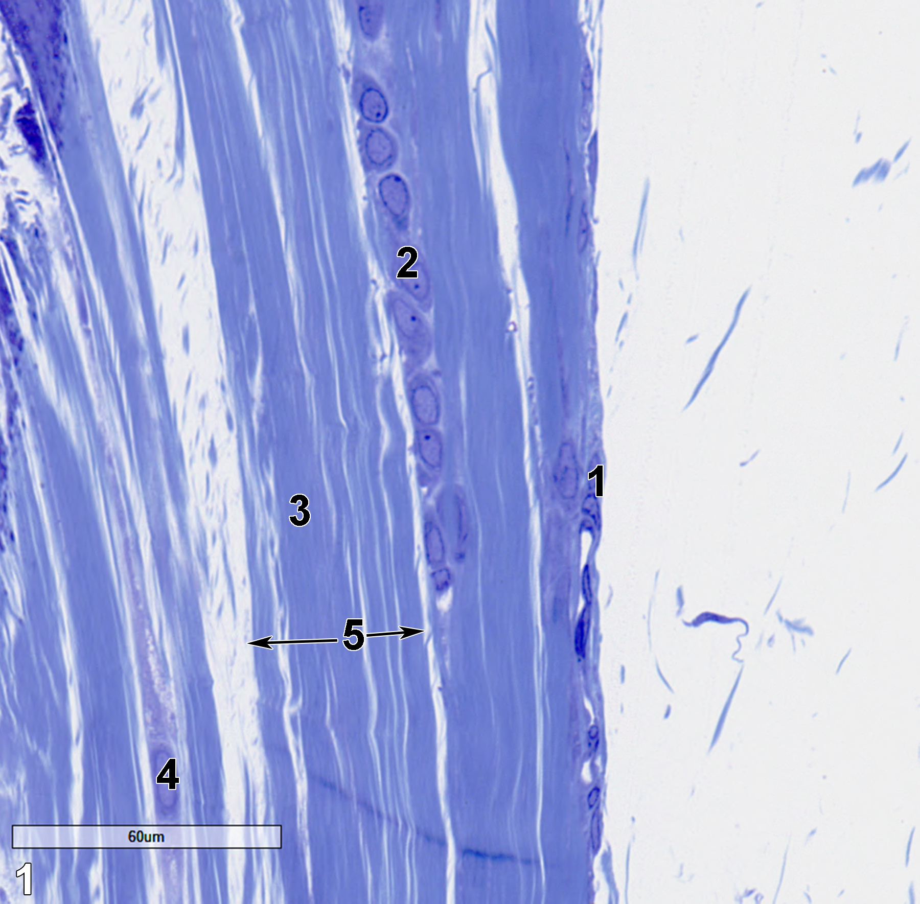 <strong>Figure 1.</strong> A semithin section (0.5 micrometer thick) of a toluidine blue O-stained view of a tendon. The thin capsule, or epitendineum (1), consists of collagenous tissue with fibroblasts. The endotendineum, (2) which is composed of collagen (3) and elastic fibers and fibroblasts (4), define the surface fascicles of a tendon (5, double arrows). 40x.