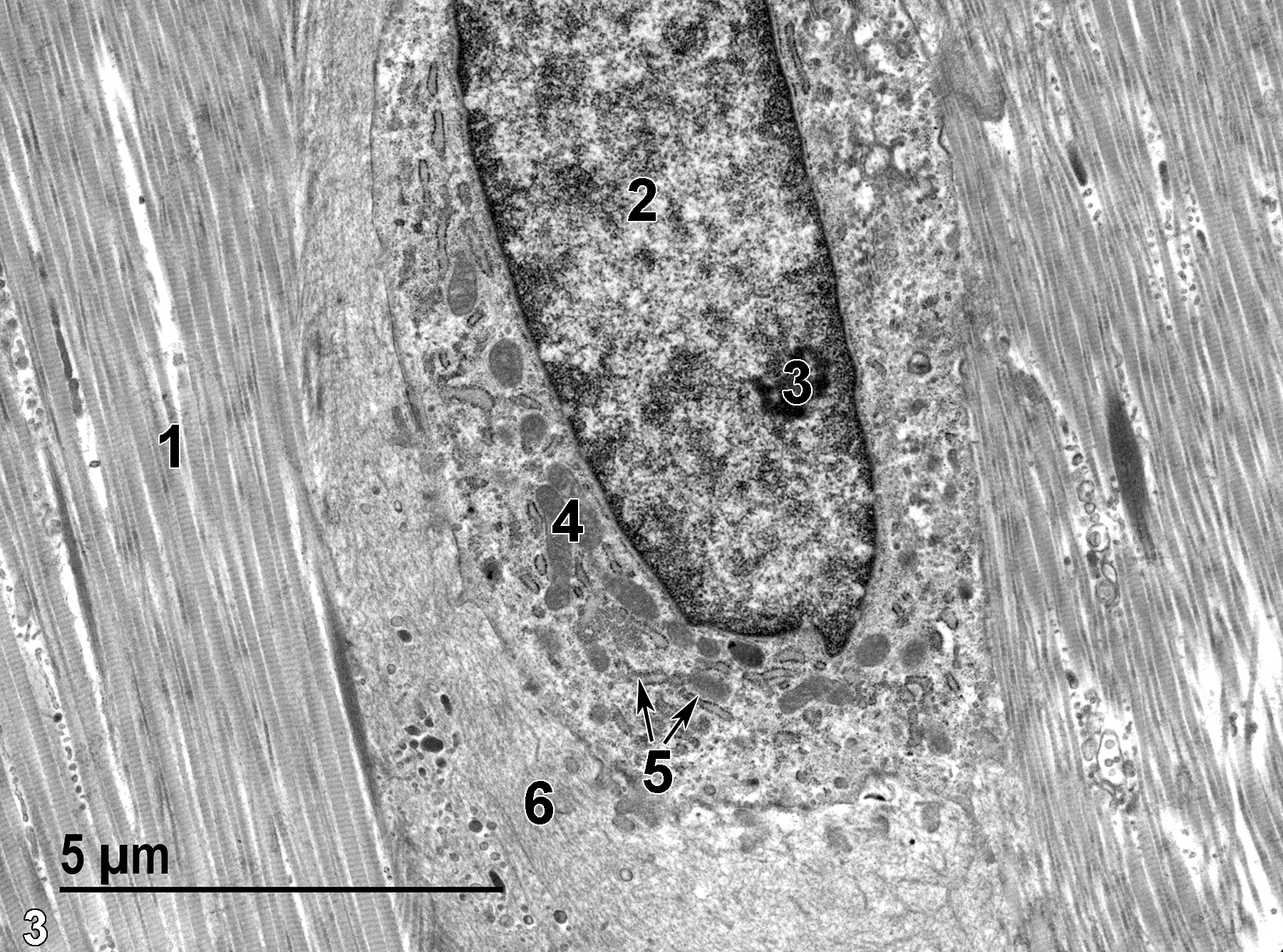 <strong>Figure 3.</strong> A higher magnification view of one of the fibroblasts in Figure 2. The fibroblast nucleus (2) contains a single nucleolus (3). The fibroblast has numerous mitochondria (4) and a prominent rough endoplasmic reticulum (5, double arrows). The fibroblast is surrounded by elastic fibers (6) and compact bundles of collagen fibers (1). 9300x.