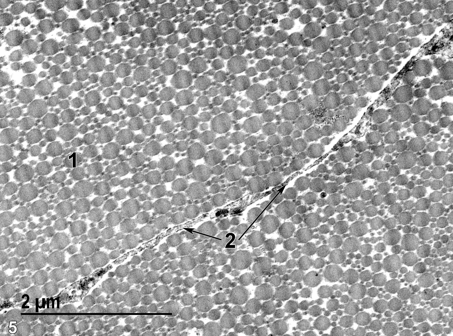 <strong>Figure 5.</strong> A high magnification image of a cross section of a tendon showing collagen fibers (1) that vary significantly in diameter. In some tendons, the collagen fiber diameters are less varied, and in these tendons, the amount of variability shown in this image might indicate tendon pathology. Cytoplasmic processes (2, double arrows) are located between adjacent fascicles of the tendon. 23000x.