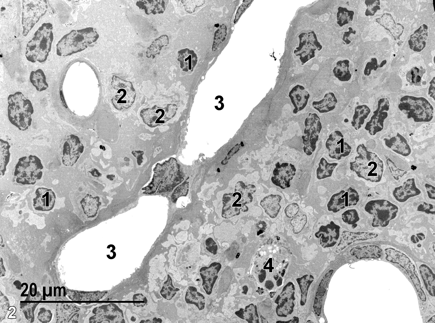 <strong>Figure 2.</strong> A low magnification electron micrograph showing lymphocytes (1) in the cortical region to the right of a longitudinal section of a blood vessel (3). A portion of the medulla is seen to the left of the long blood vessel along with another lymphocyte (1). Note the larger, somewhat lighter stained nuclei of reticular epithelial cells (2). One macrophage (4) is seen in the cortical region. 1900x.
