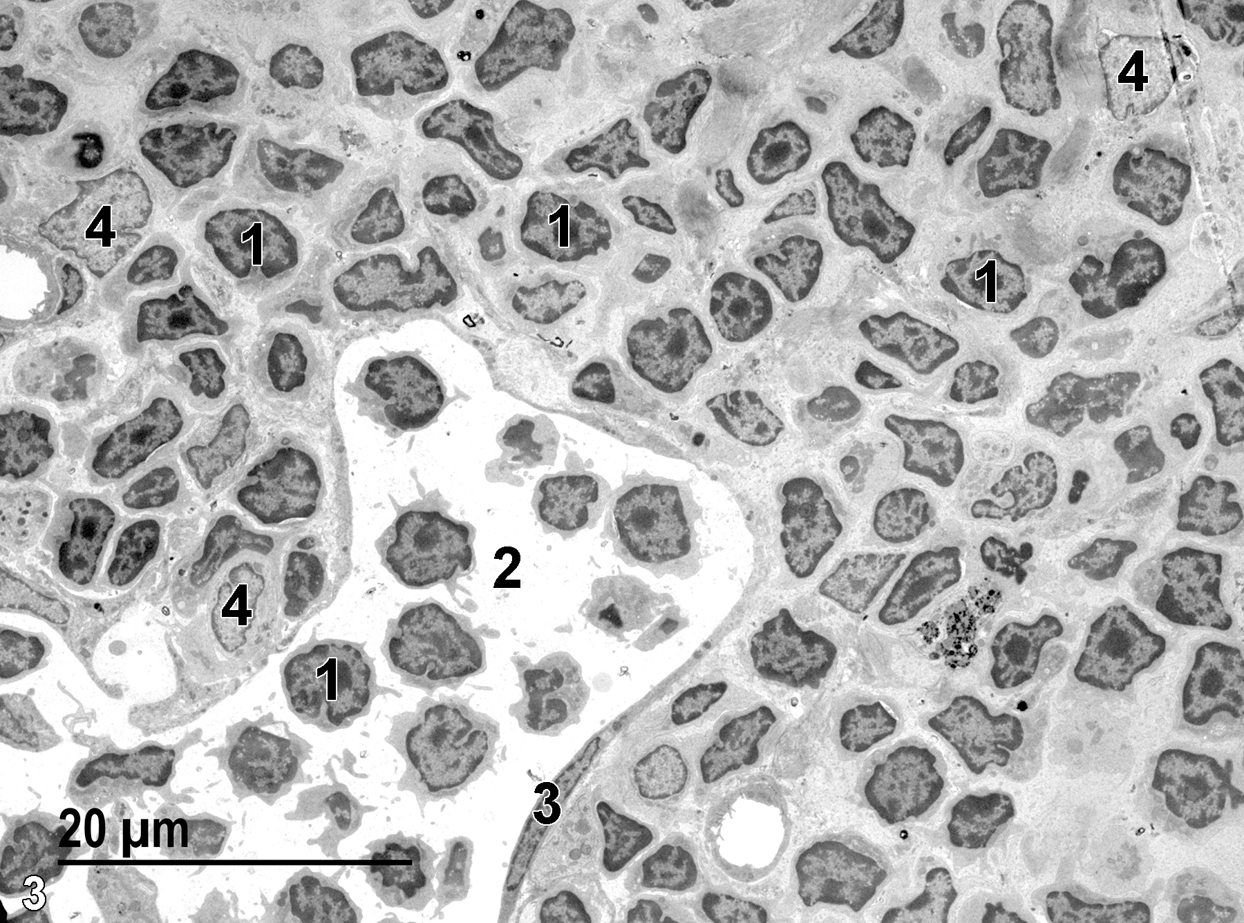 <strong>Figure 3.</strong> Another low magnification view of the thymus cortex with a dense accumulation of small lymphocytes (1) with prominent darkly stained nuclei and scant cytoplasm, a capillary (2) with an elongated endothelial cell nucleus (3), and reticular epithelial cells (4) with lighter stained nuclei than that seen in the lymphocytes. 1900x.