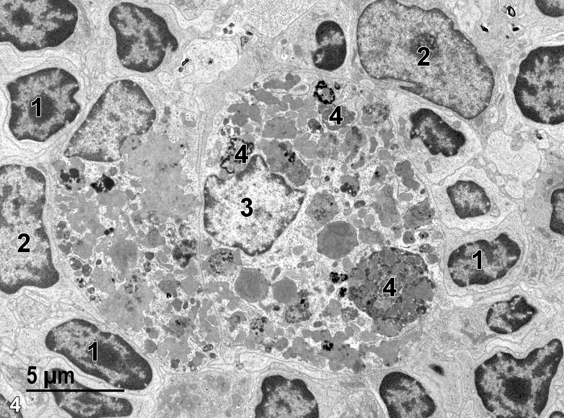 <strong>Figure 4.</strong> A portion of the cortex containing small lymphocytes with scant cytoplasm and nuclei (1), with prominent nucleoli and marginated heterochromatin. Two nuclei of reticular epithelial cells (2) are shown, which are large and less densely stained than the lymphocyte nuclei. A macrophage is shown with a single nucleus (3) and numerous lysosomes (4). 4800x.