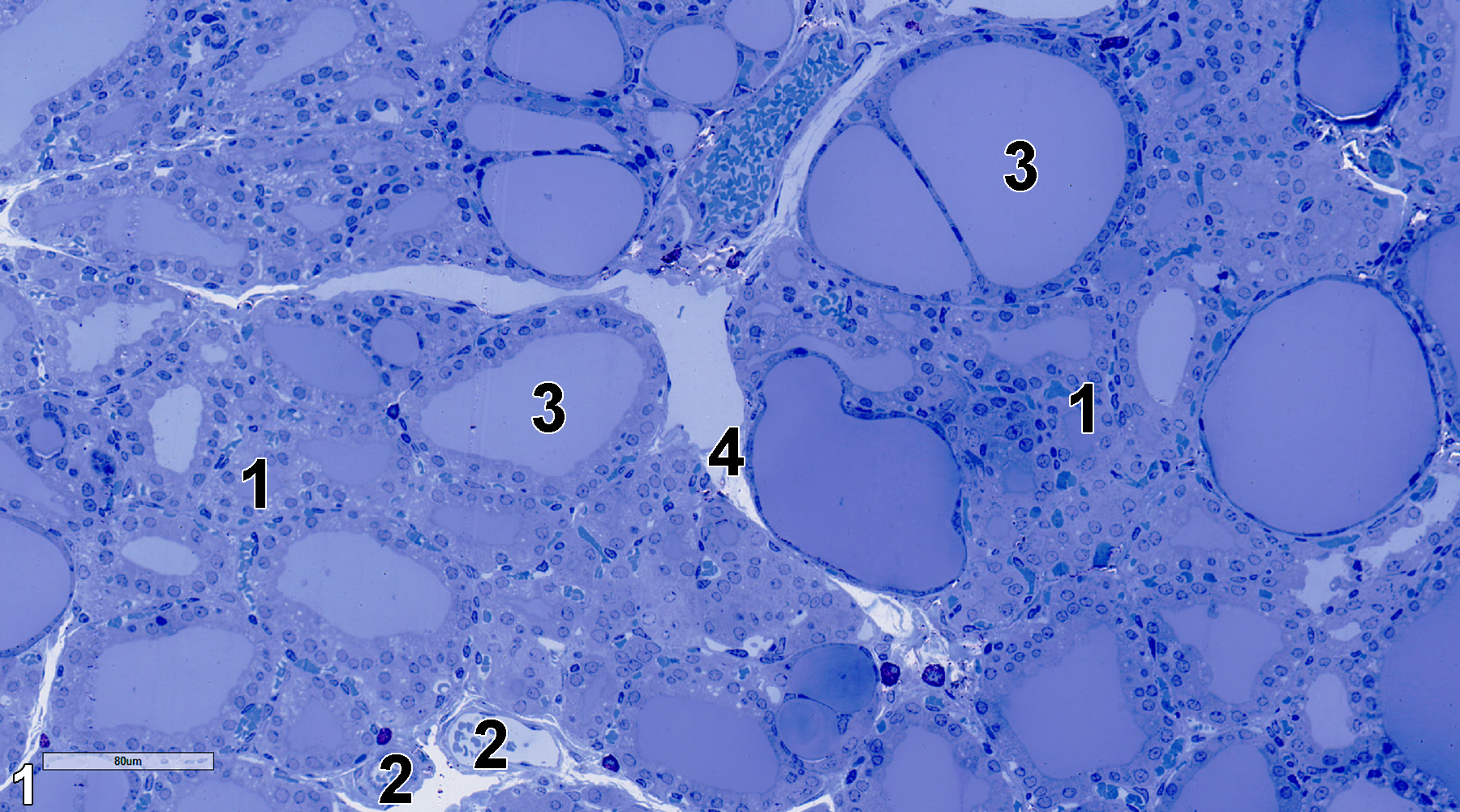 <strong>Figure 1.</strong> A semithin section (0.5 micrometer thick) of a toluidine blue O-stained area of the thyroid gland. Lobules (1) separated by septa composed of connective tissue (4) have follicles with cuboidal epithelial cells surrounding luminal spaces (3) containing colloid. Capillaries (2) containing erythrocytes. 25x.