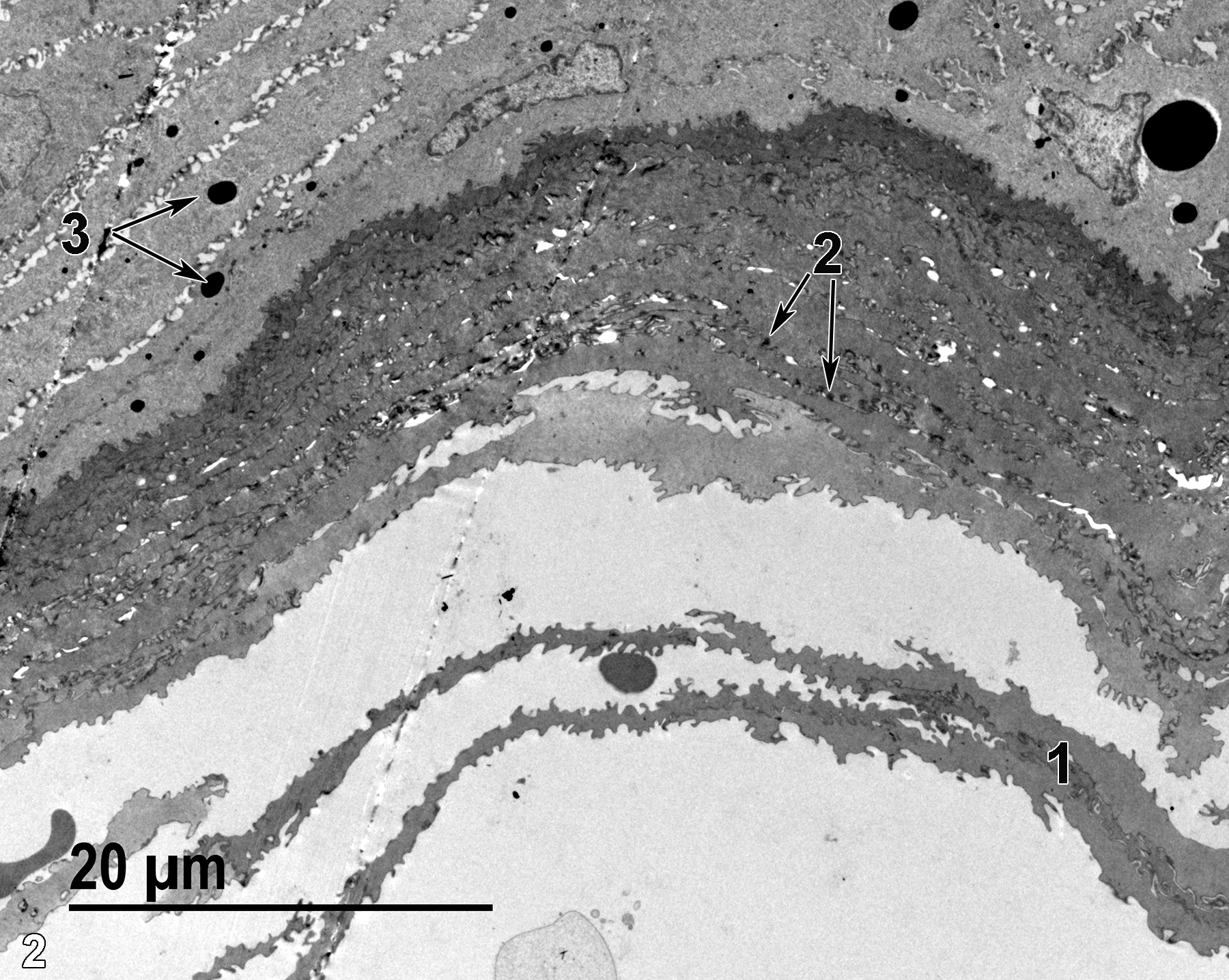<strong>Figure 2.</strong> An ultrastructural view of the dorsal side of the tongue’s epithelial cell surface. Several cell layers of the keratinized epithelium (1) slough off of the epithelial surface. Small keratohyalin granules (2, arrows) can be seen in the superficial epithelial cells, whereas larger keratohyalin granule precursors (3, arrows) can be seen in more basal epithelial cells. 1900x.