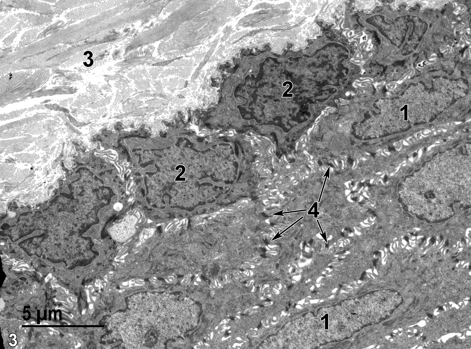 <strong>Figure 3.</strong> An electron micrograph of the basal side of the epithelial layer of the tongue. Stratified squamous epithelial cells have elongated nuclei (1) compared with the more rounded nuclei (2) of the basal cells. Bundles of collagen (3) are the predominant feature of the lamina propria. Note the large numbers of desmosomes (4, arrows) that hold the spinose projections of the adjacent cells together. 4800x.