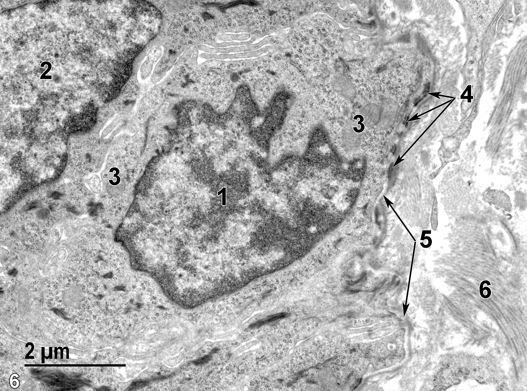 <strong>Figure 6.</strong> A high magnification view of a basal cell of the epithelial cell layer. The nucleus of the basal cell (1) is more rounded than that of the elongated nucleus of the stratified epithelial cell (2). The basal cell has several mitochondria (3), as well as numerous hemidesmosomes (4, arrows) along the basal lamina (5, arrows) that separates the basal cell layer from the underlying collagen (6) of the lamina propria. 13000x.
