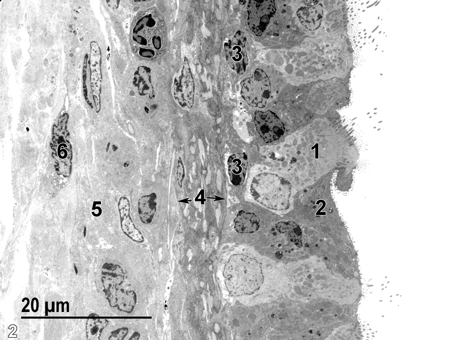 <strong>Figure 2.</strong> A low magnification electron micrograph of the tracheal mucosa and submucosa, with the tracheal lumen present on the right of the image. The pseudostratified epithelium shown is made up of ciliated cells (1), non-ciliated mucous cells (2), and basal cells (3). At the base of the mucosal layer is the lamina propria (4, arrows), which is composed primarily of bundles of collagen fibrils and fibroblasts. The submucosal layer is also composed of a collagenous matrix (5) with its associated fibroblasts (6). 1900x.
