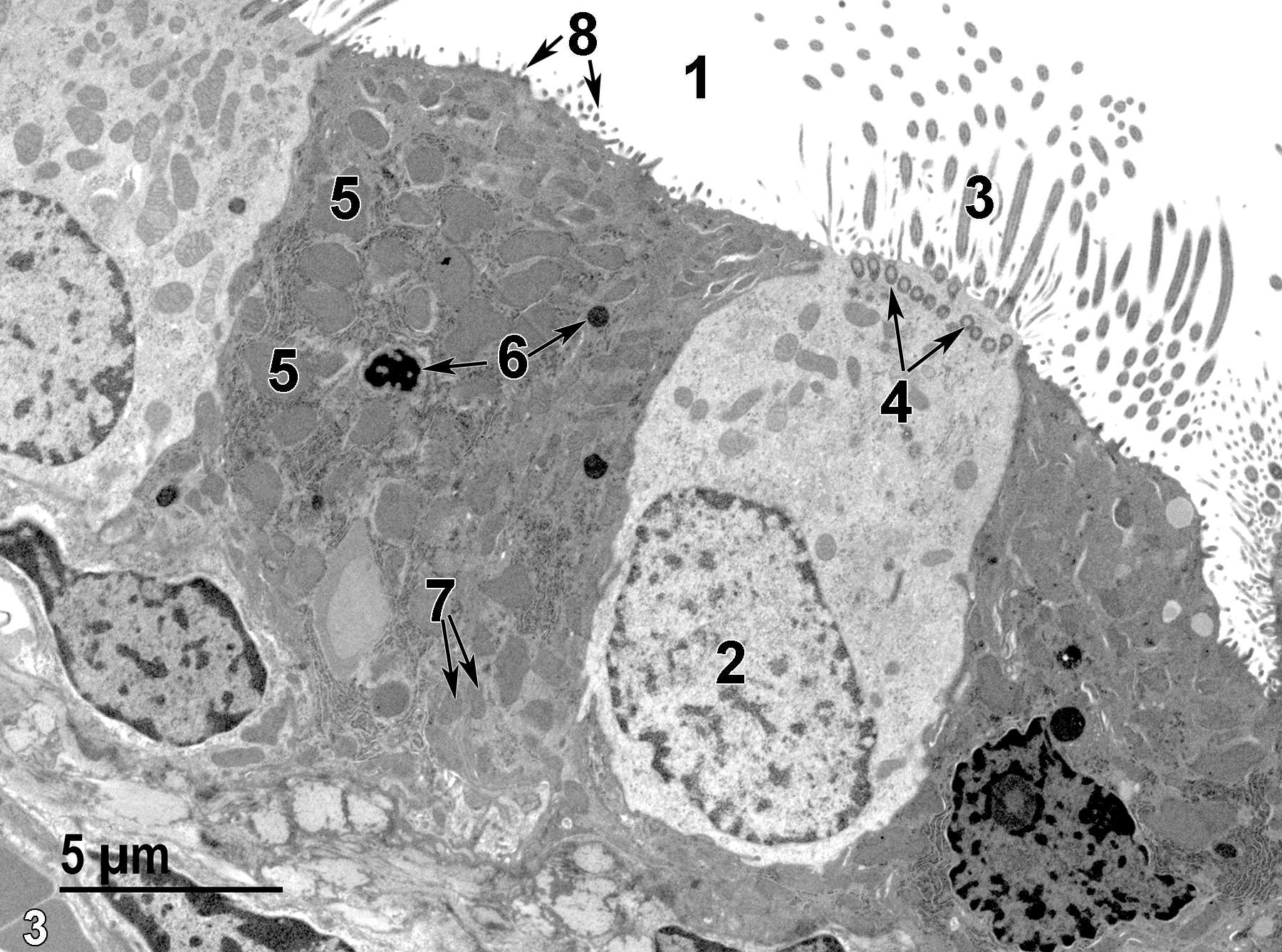 <strong>Figure 3.</strong> A higher magnification view of the epithelial surface. The tracheal lumen (1) is lined with the two major types of epithelial cells. A ciliated epithelial cell nucleus (2) is shown, as well as cilia (3) and apical basal bodies (4, arrows). The mucous cell shown contains numerous pleomorphic mucous granules (5), some lysosomes (6, arrows), and mitochondria (7, arrows). Short microvilli (8, arrows) are visible at the surface of the mucous cell. 4800x.