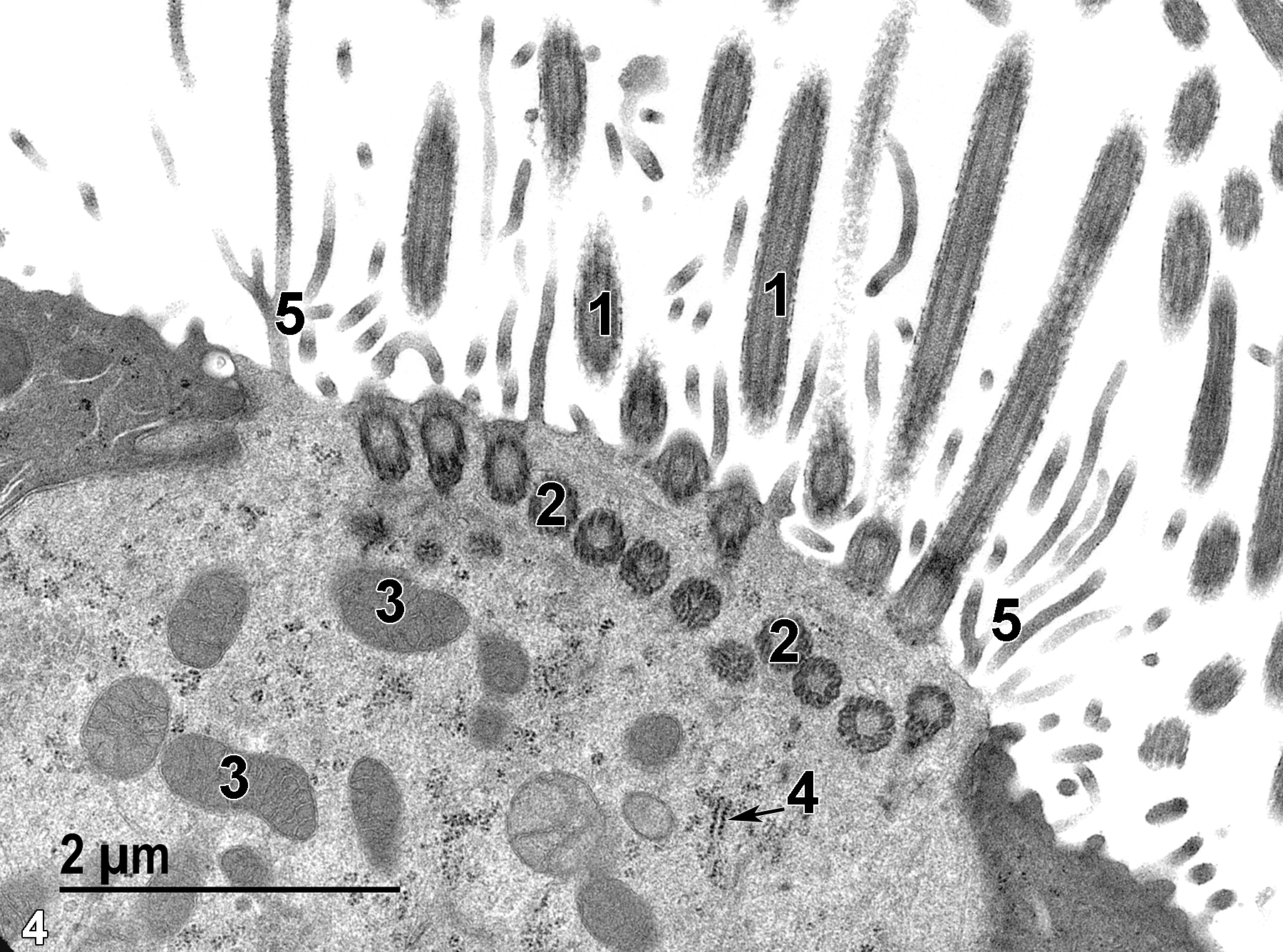 <strong>Figure 4.</strong> A high magnification view of the apical region of a ciliated epithelial cell that shows cilia (1), basal bodies (2) of the cilia, mitochondria (3), a segment of rough endoplasmic reticulum (4, arrow), and long and sometimes branched microvilli (5). Note that they are much longer than the microvilli on the surface of the two adjacent mucous cells with darker cytoplasm. 18500x.