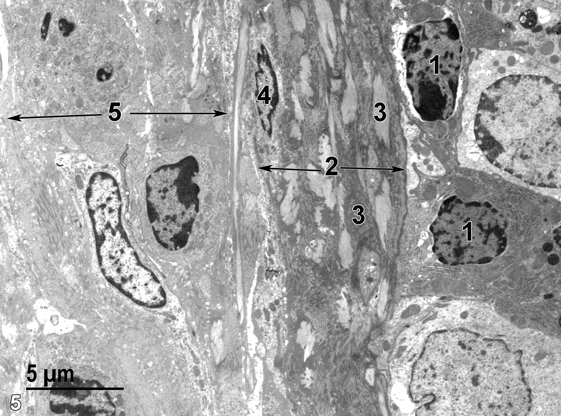 <strong>Figure 5.</strong> A view of the lamina propria (2, arrows) and submucosa (5, arrows) below the mucosal layer. Nuclei of two basal cells (1) in the epithelial cell layer are shown. Below them are bundles of collagen fibrils (3) and a fibroblast (4) in the lamina propria. The submucosal layer is also composed of a collagenous matrix with embedded fibroblasts. 4800x.